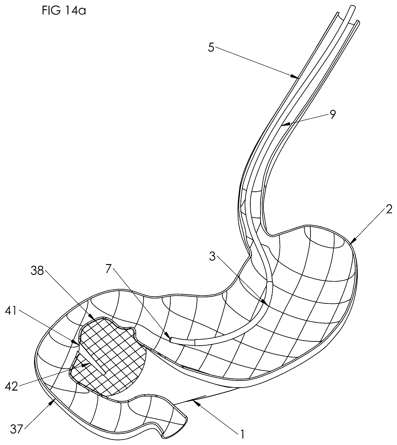 Patent US12102558 Figure 8 – Apparatus and method for cooling and/or heating an organ