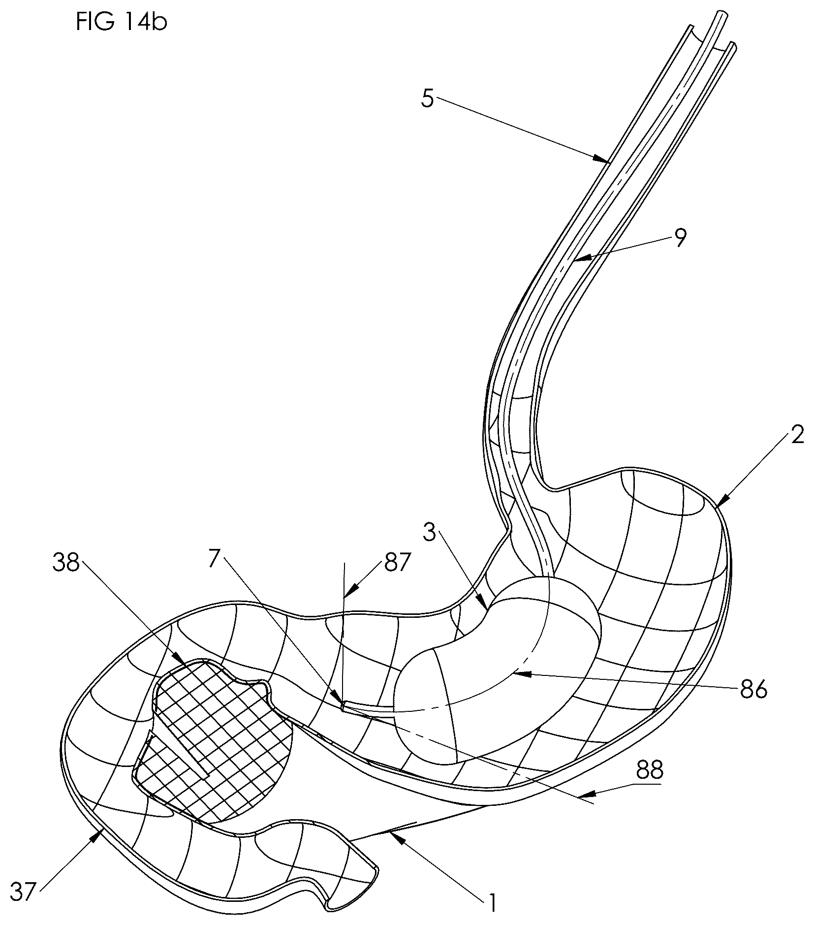 Patent US12102558 Figure 9 – Apparatus and method for cooling and/or heating an organ