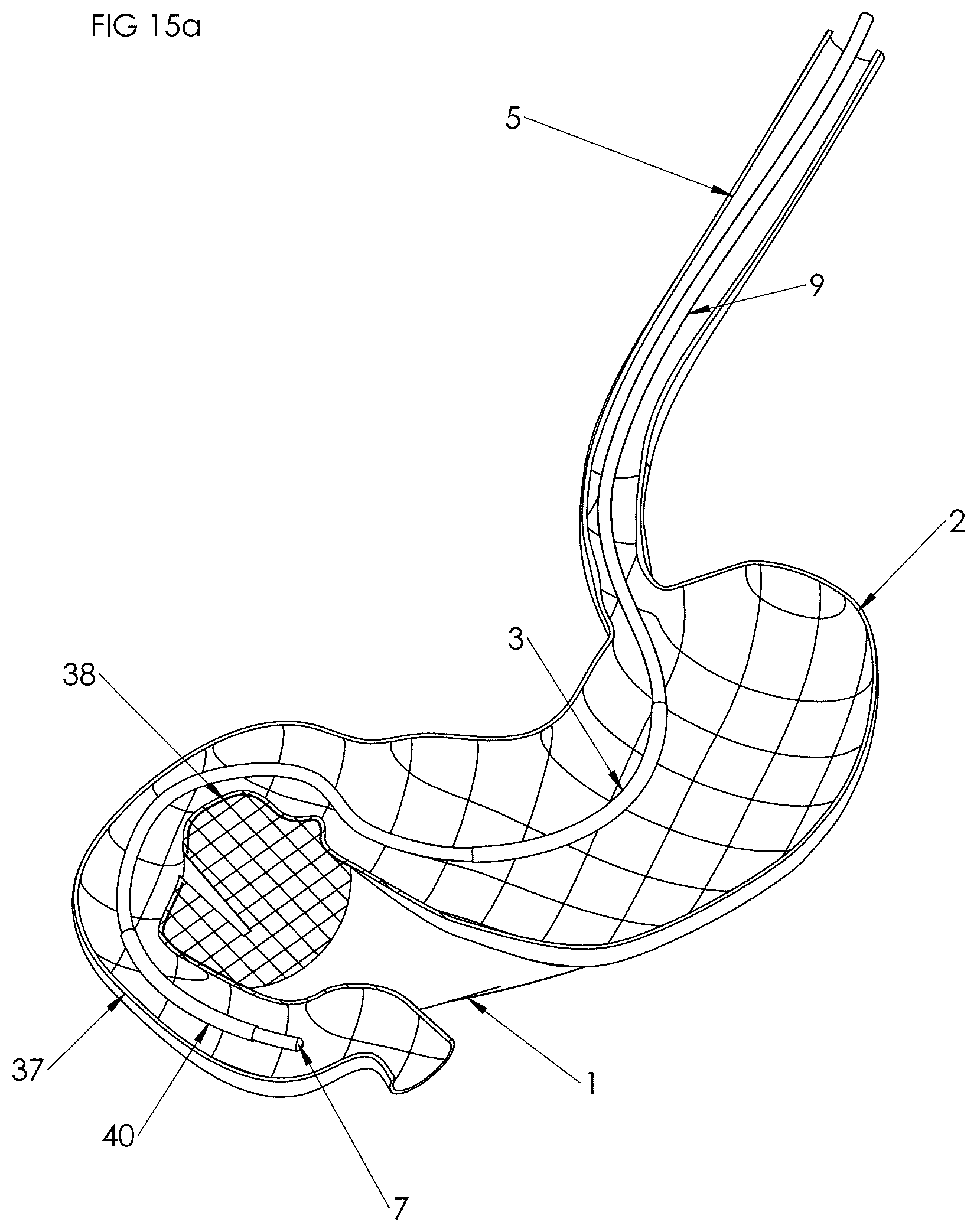 Patent US12102558 Figure 10 – Apparatus and method for cooling and/or heating an organ
