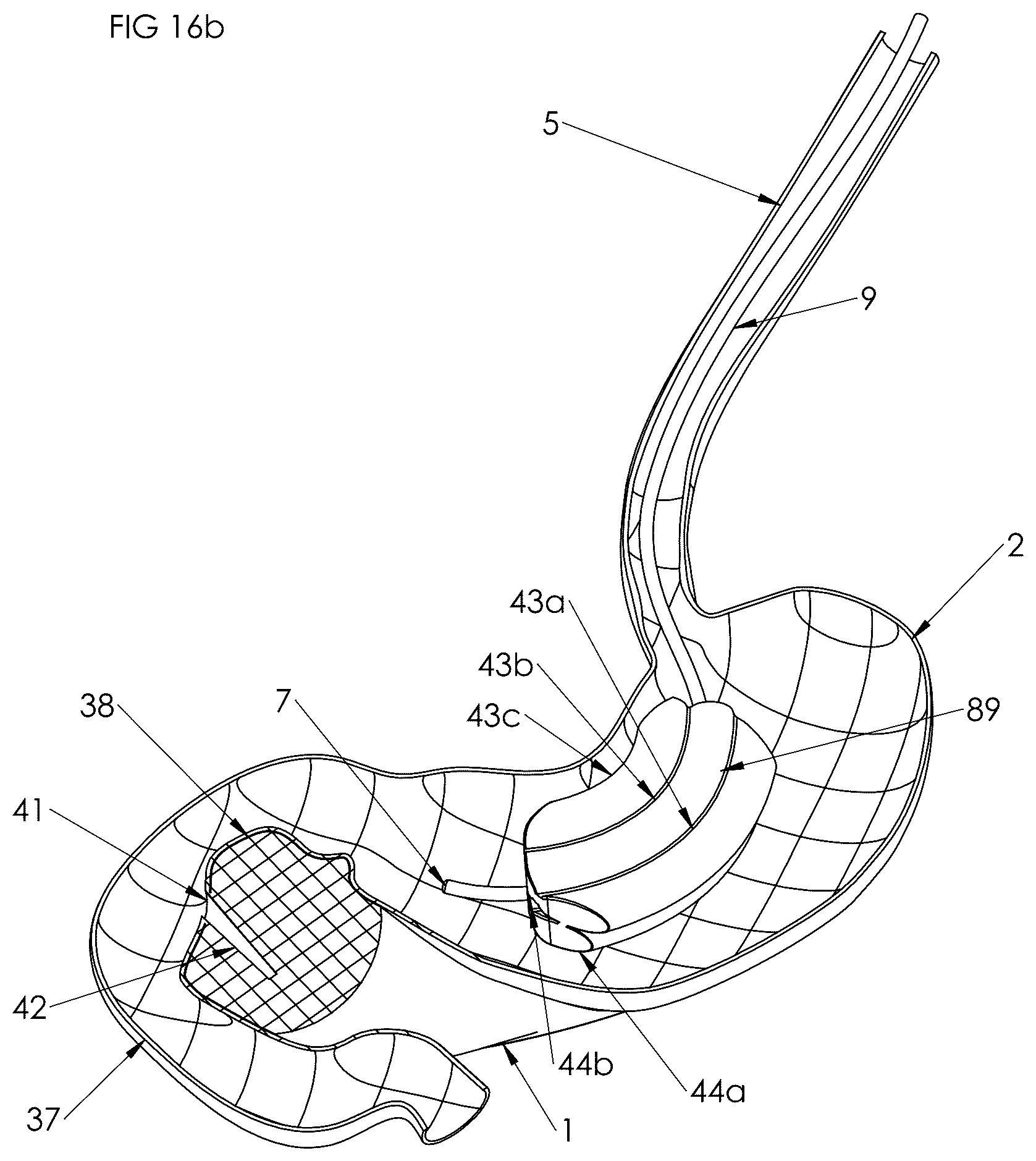 Patent US12102558 Figure 14 – Apparatus and method for cooling and/or heating an organ