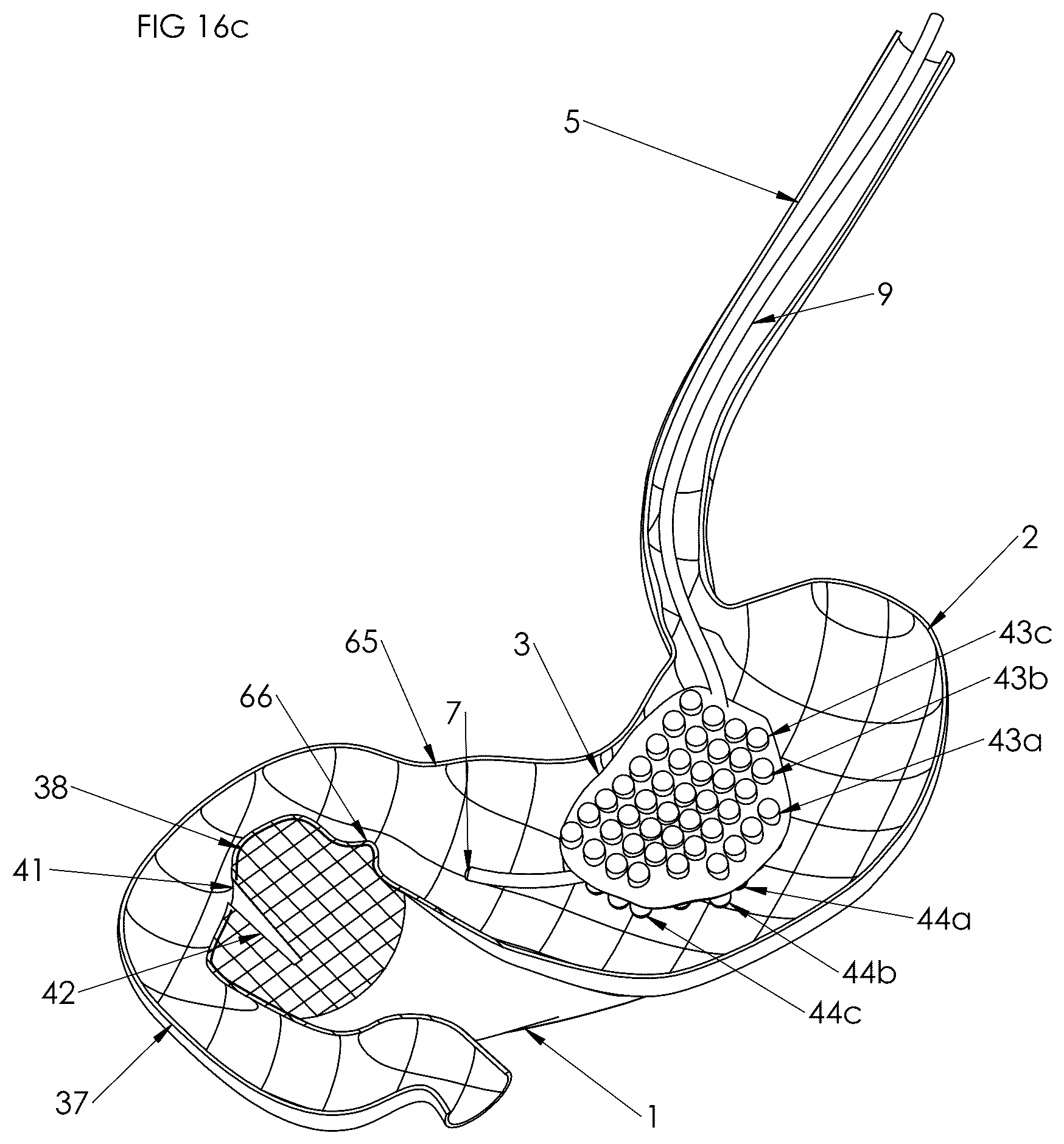 Patent US12102558 Figure 15 – Apparatus and method for cooling and/or heating an organ