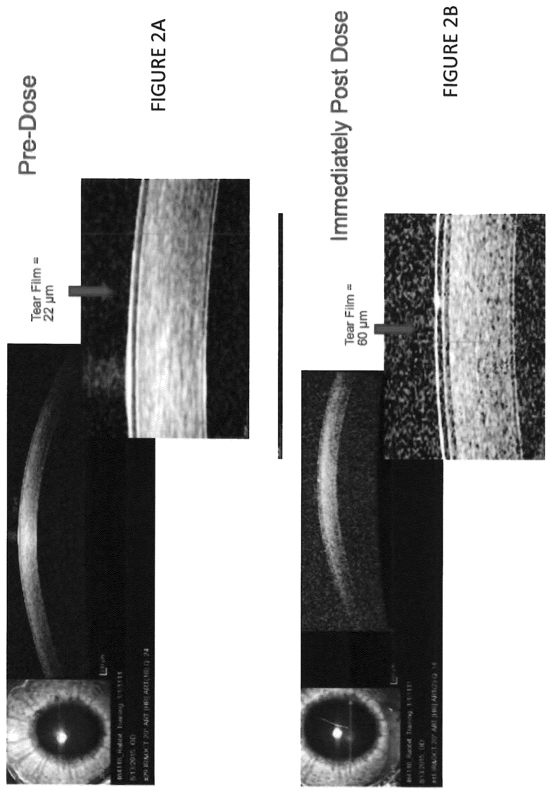 Patent US12102559 Figure 2 – Dissolvable polymeric eye inserts and method of using same