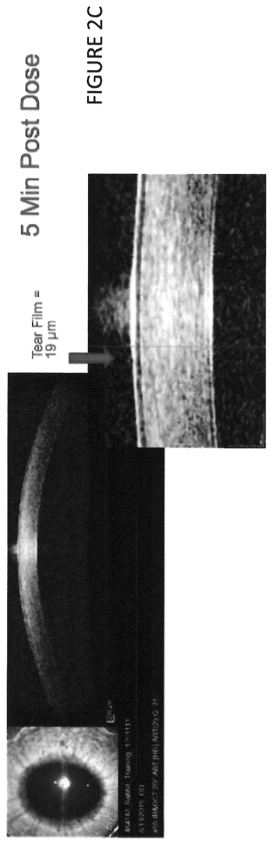 Patent US12102559 Figure 3 – Dissolvable polymeric eye inserts and method of using same