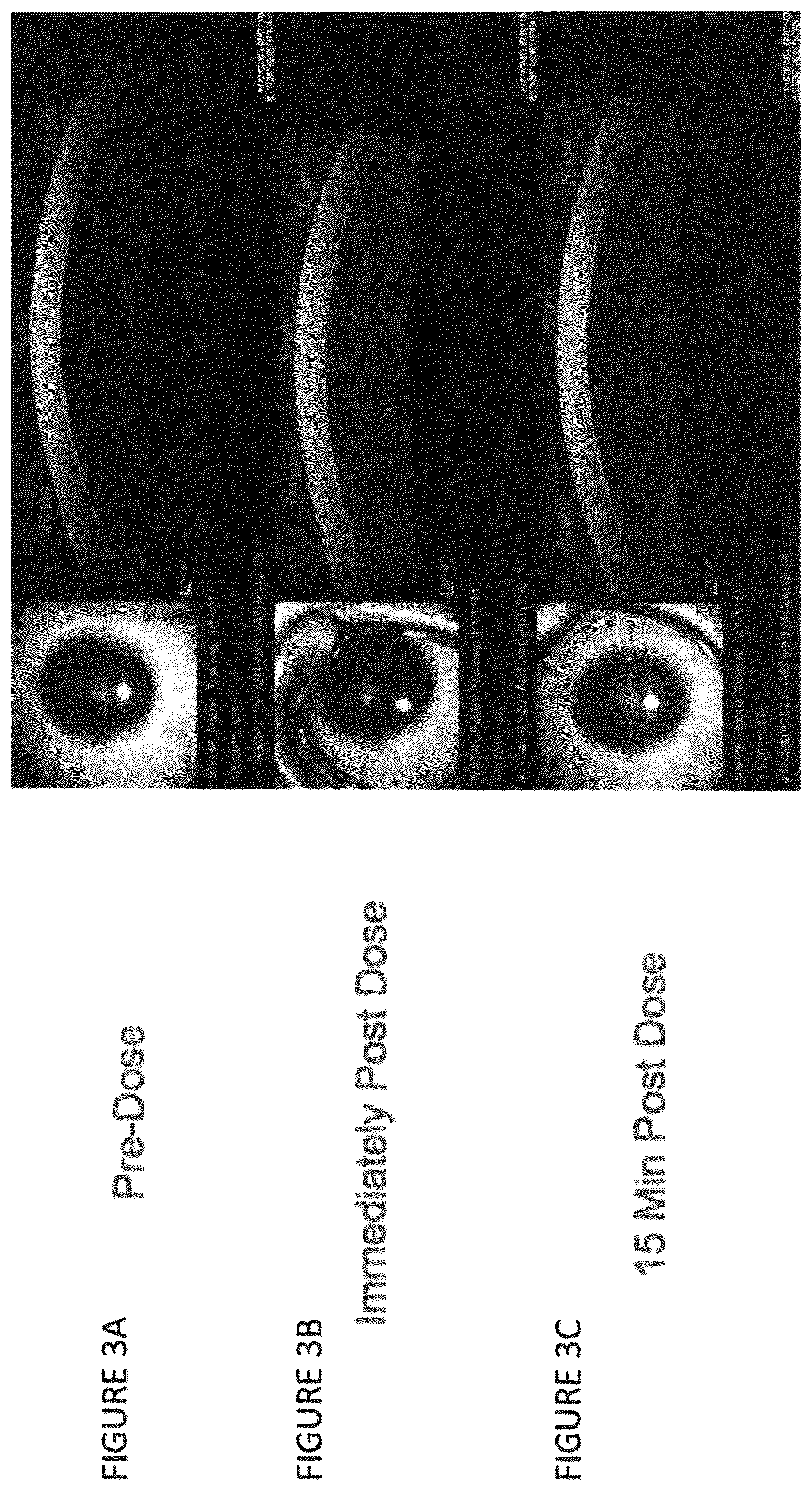 Patent US12102559 Figure 4 – Dissolvable polymeric eye inserts and method of using same