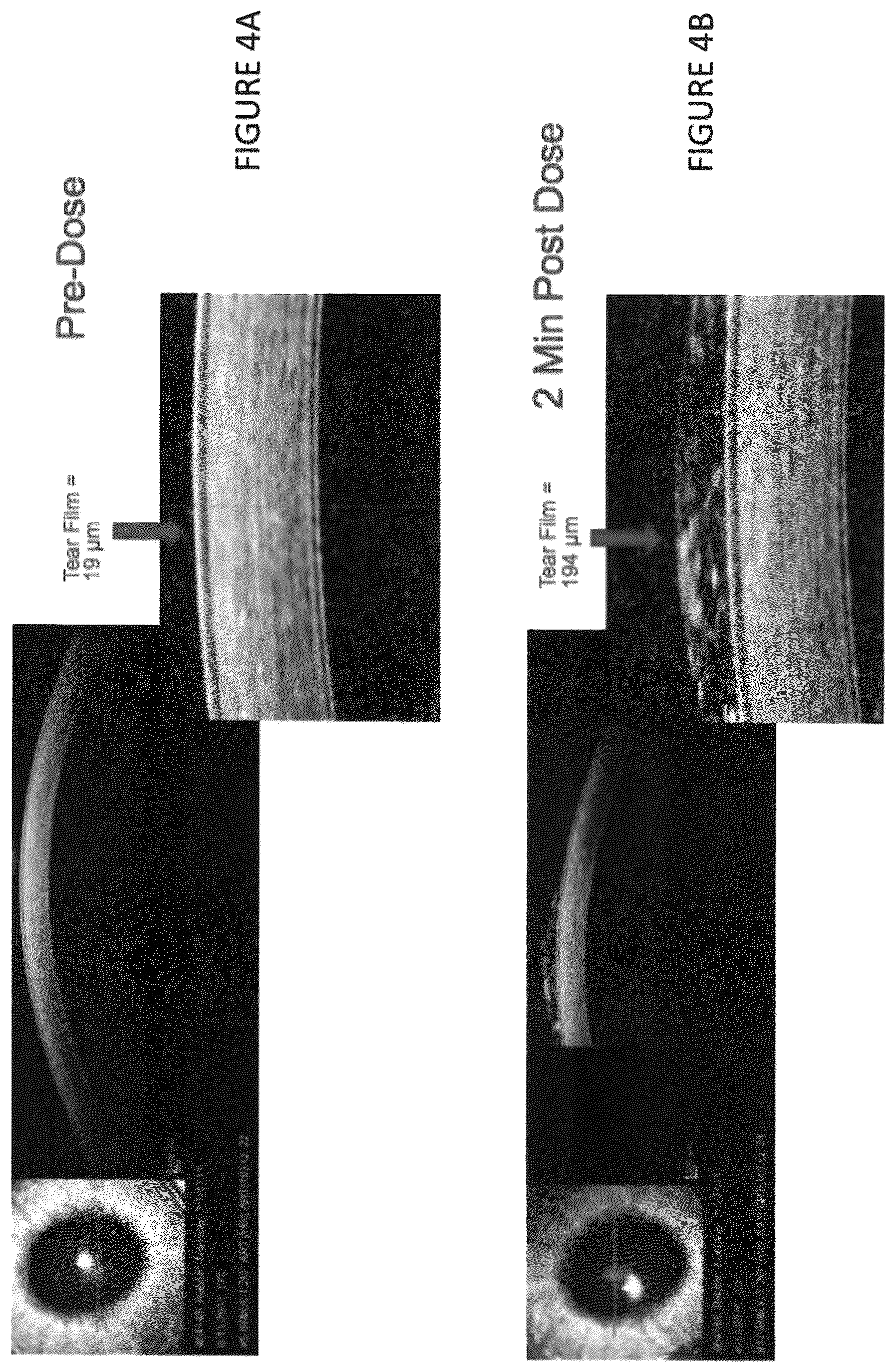 Patent US12102559 Figure 5 – Dissolvable polymeric eye inserts and method of using same