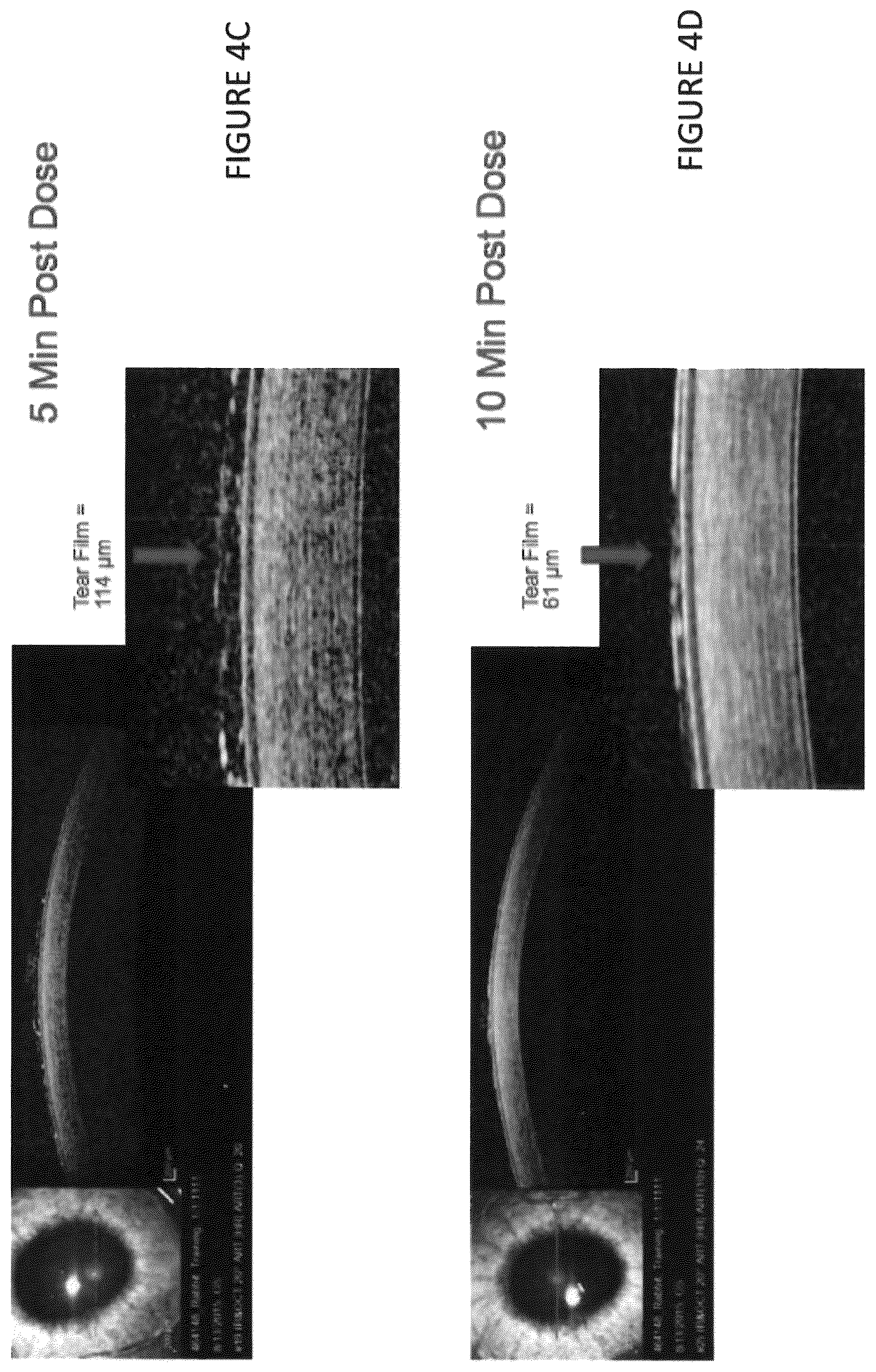 Patent US12102559 Figure 6 – Dissolvable polymeric eye inserts and method of using same