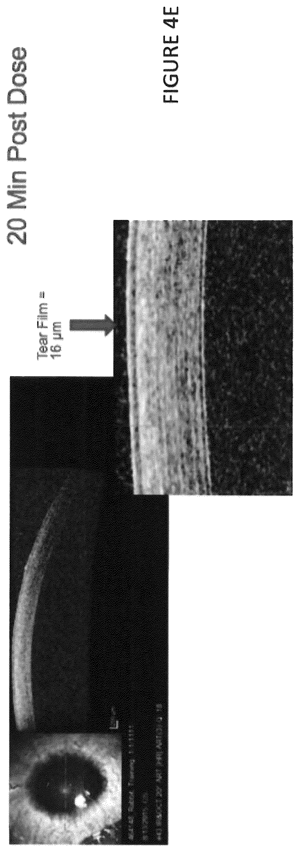 Patent US12102559 Figure 7 – Dissolvable polymeric eye inserts and method of using same