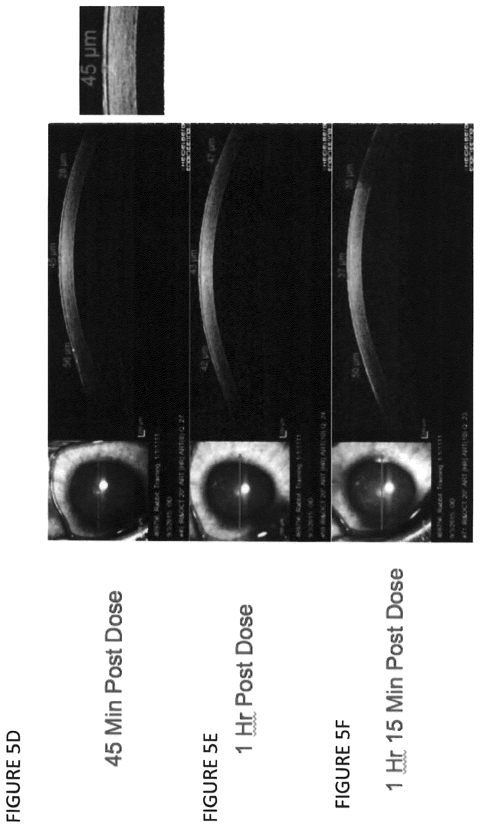 Patent US12102559 Figure 9 – Dissolvable polymeric eye inserts and method of using same