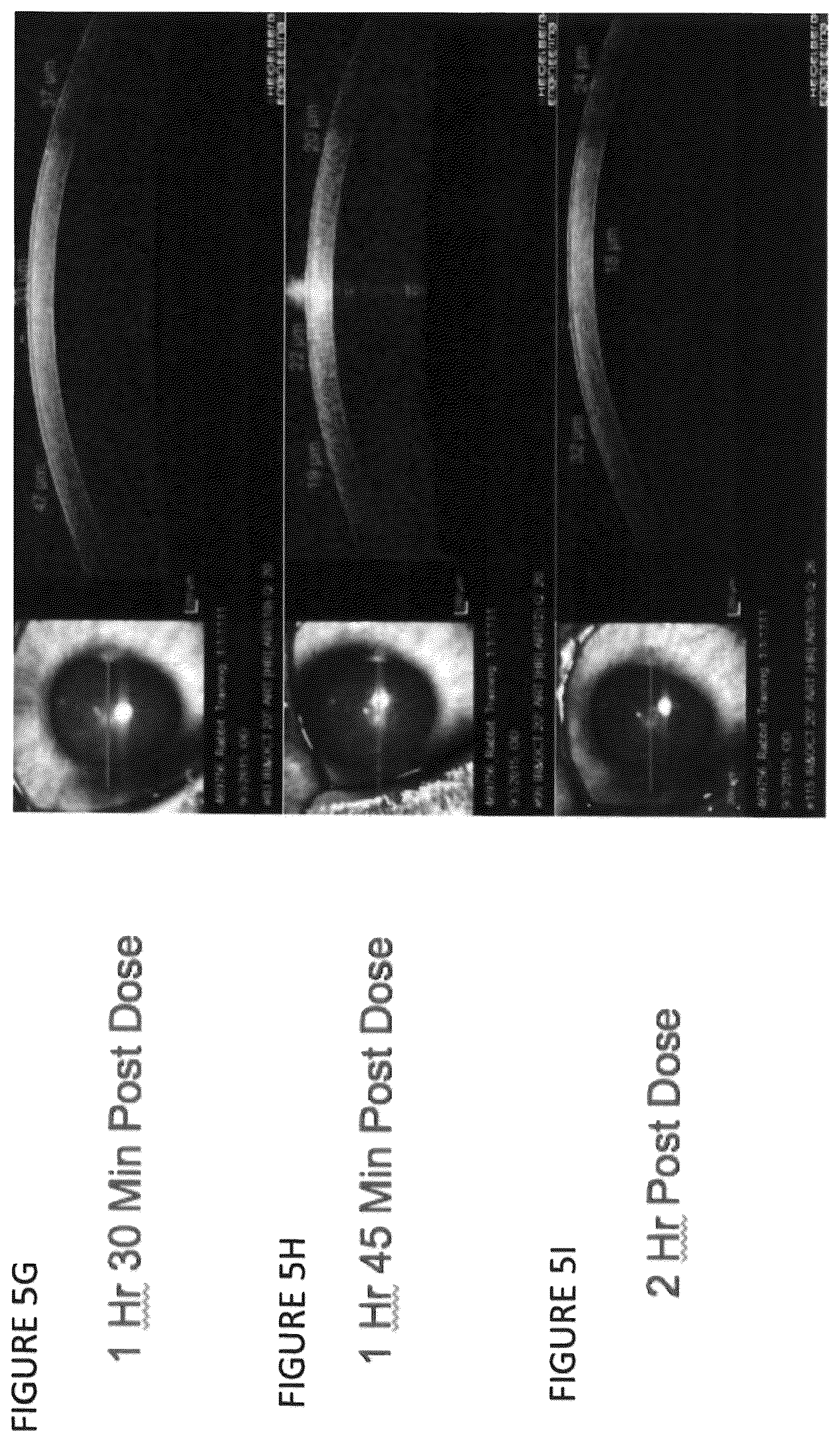 Patent US12102559 Figure 10 – Dissolvable polymeric eye inserts and method of using same