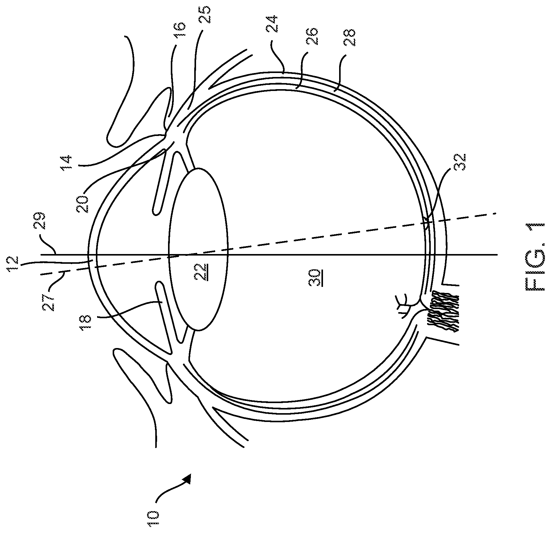 Patent US12102560 Figure 1 – Implantable ocular drug delivery devices