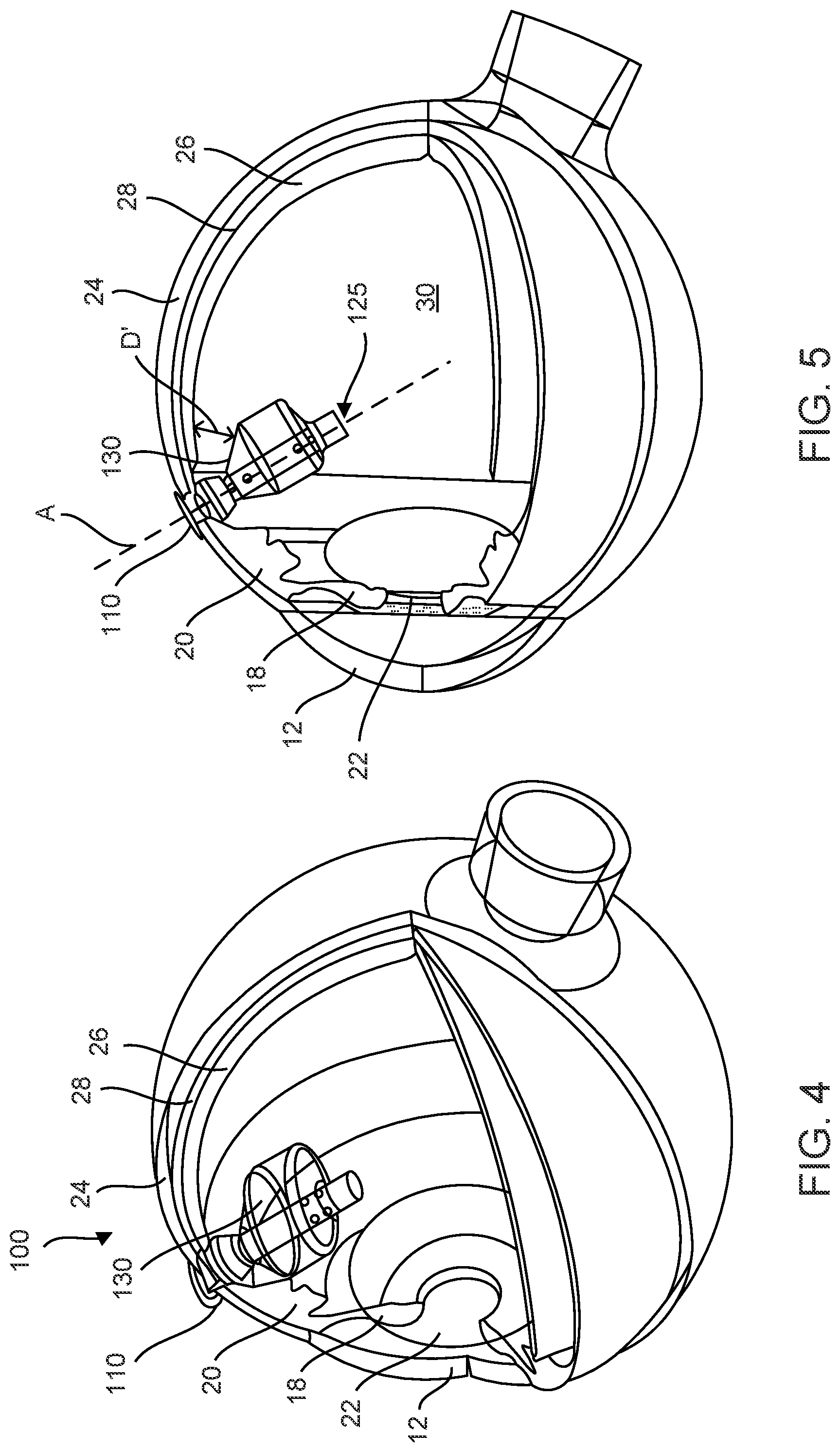 Patent US12102560 Figure 4 – Implantable ocular drug delivery devices