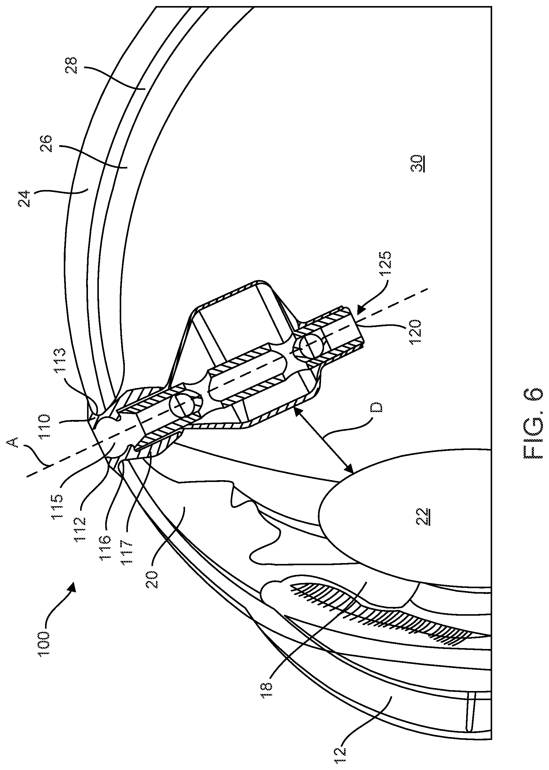 Patent US12102560 Figure 5 – Implantable ocular drug delivery devices