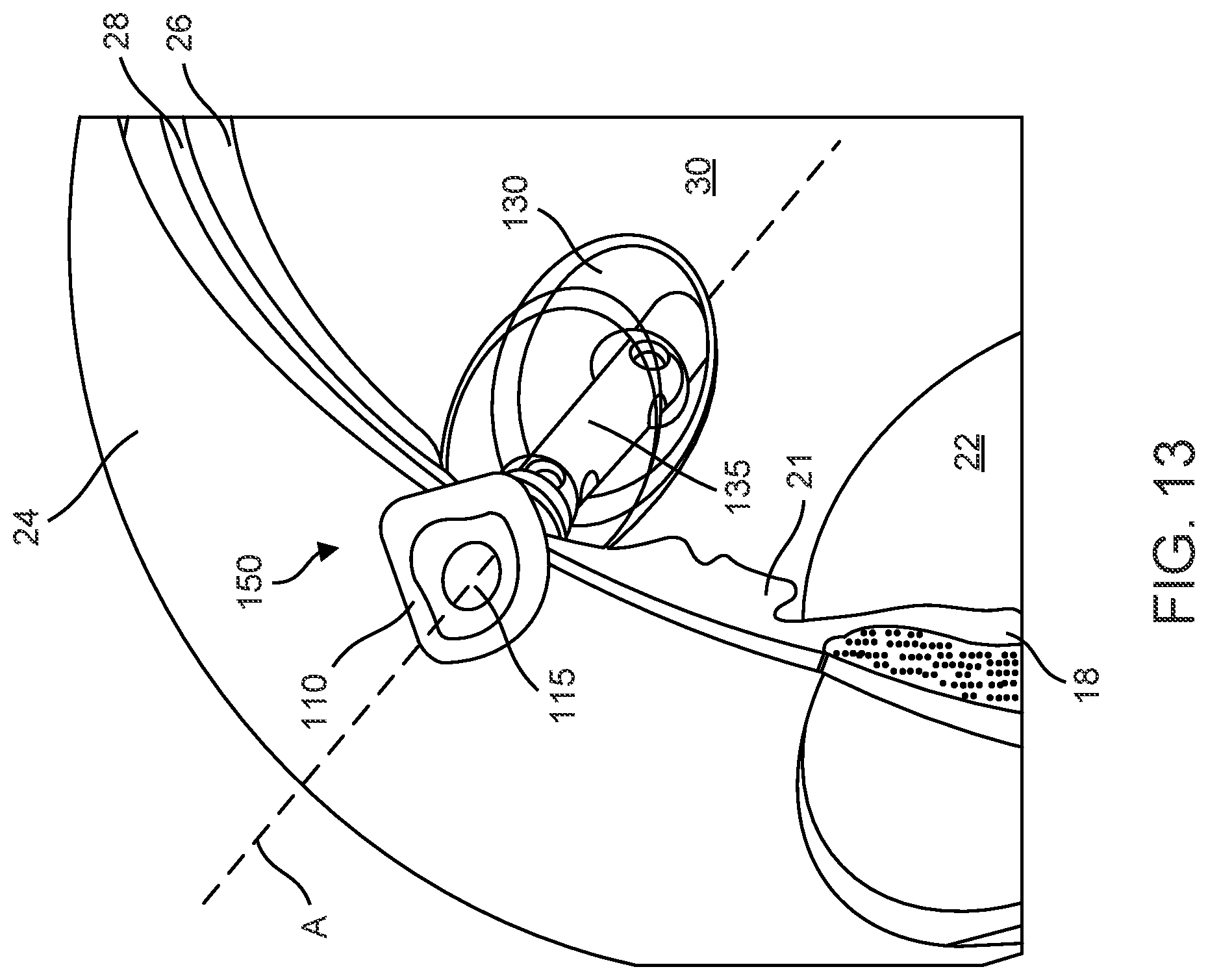Patent US12102560 Figure 11 – Implantable ocular drug delivery devices