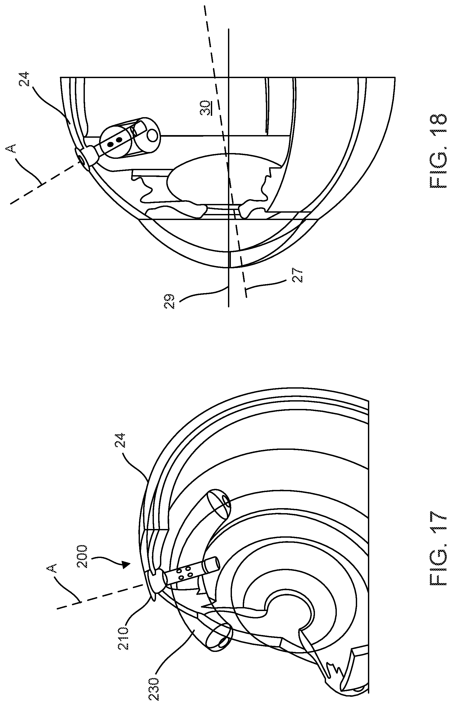 Patent US12102560 Figure 13 – Implantable ocular drug delivery devices