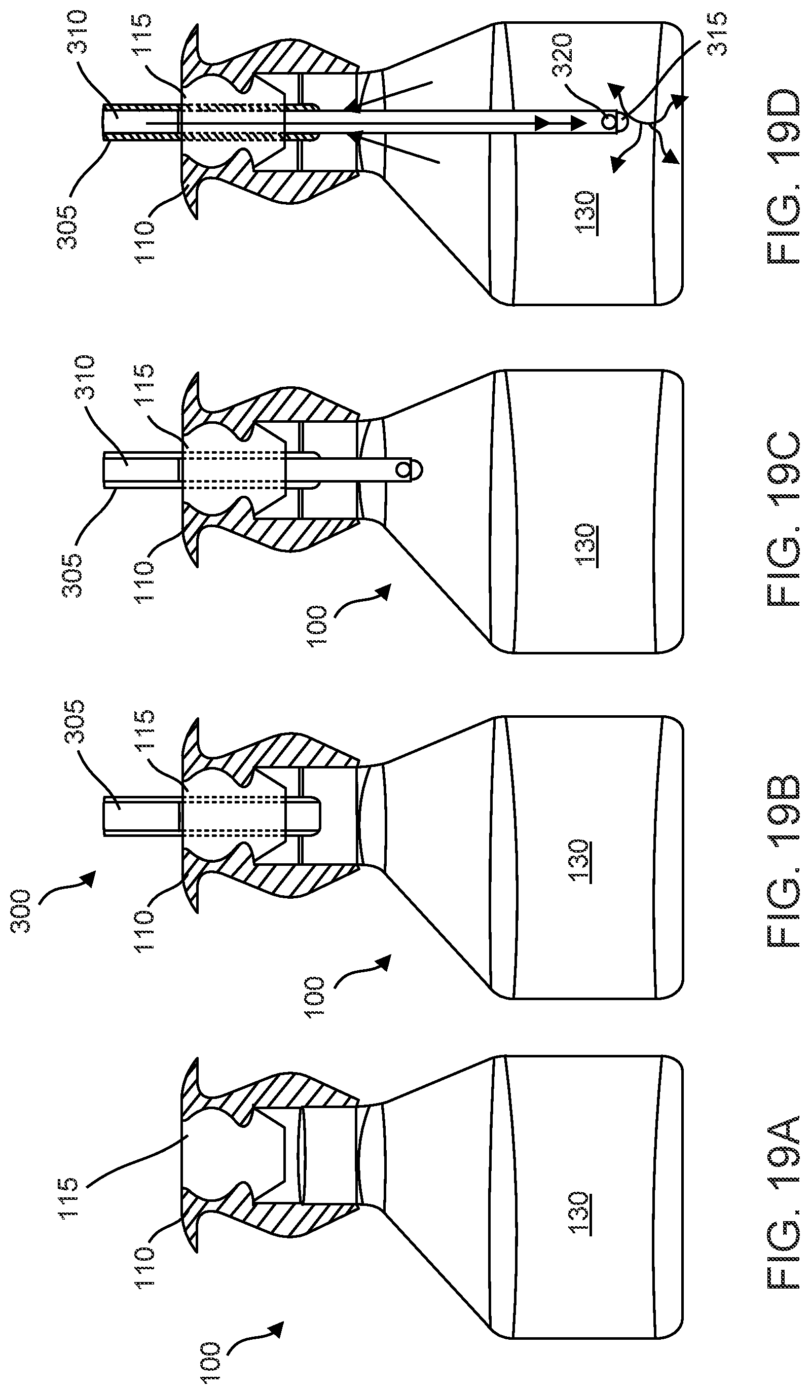 Patent US12102560 Figure 14 – Implantable ocular drug delivery devices