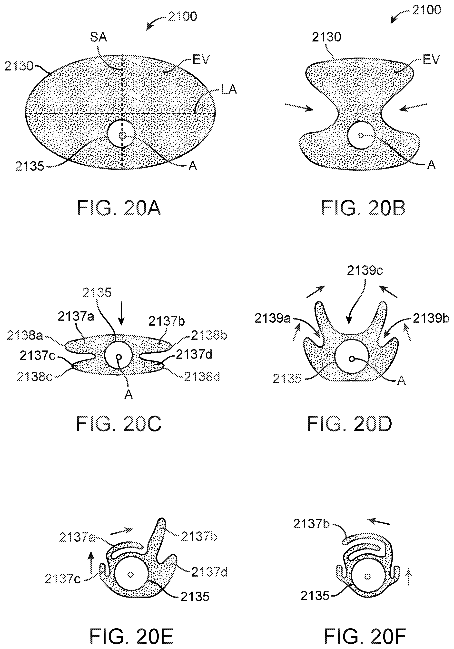 Patent US12102560 Figure 15 – Implantable ocular drug delivery devices