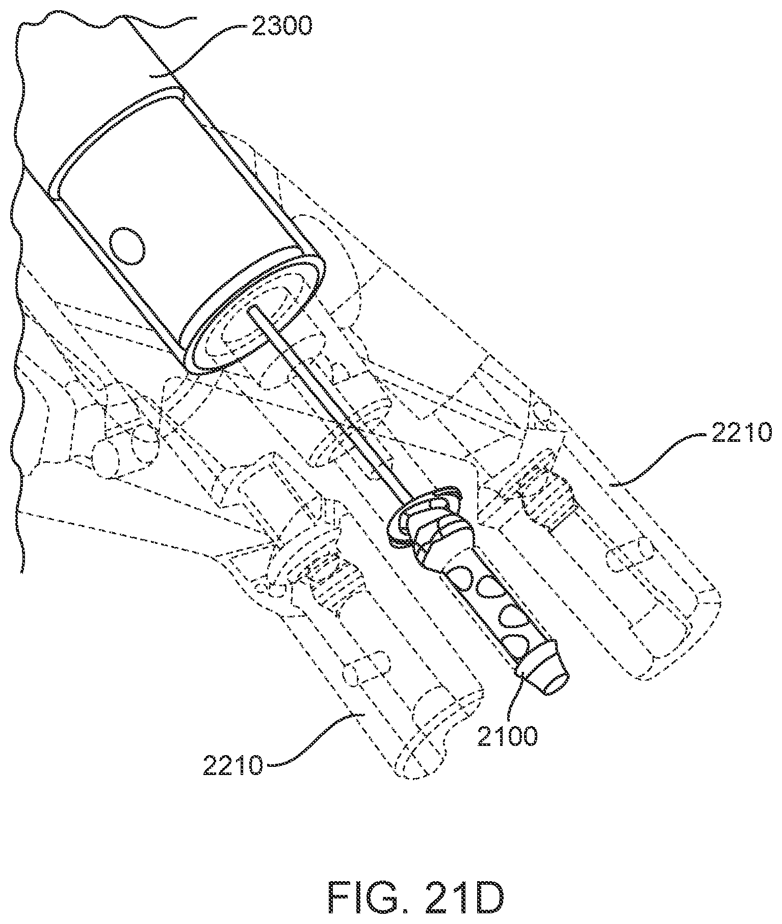 Patent US12102560 Figure 18 – Implantable ocular drug delivery devices
