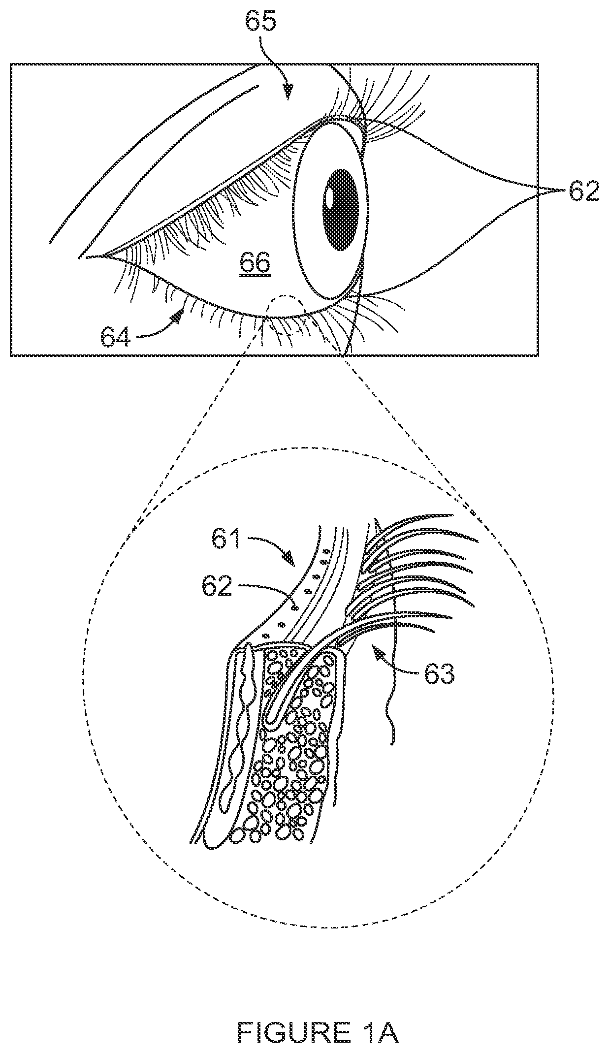 Patent US12102561 Figure 1 – Multi-modal thermal therapy for Blepharitis, Meibomian Gland Dysfunction and Dry Eye Syndrome