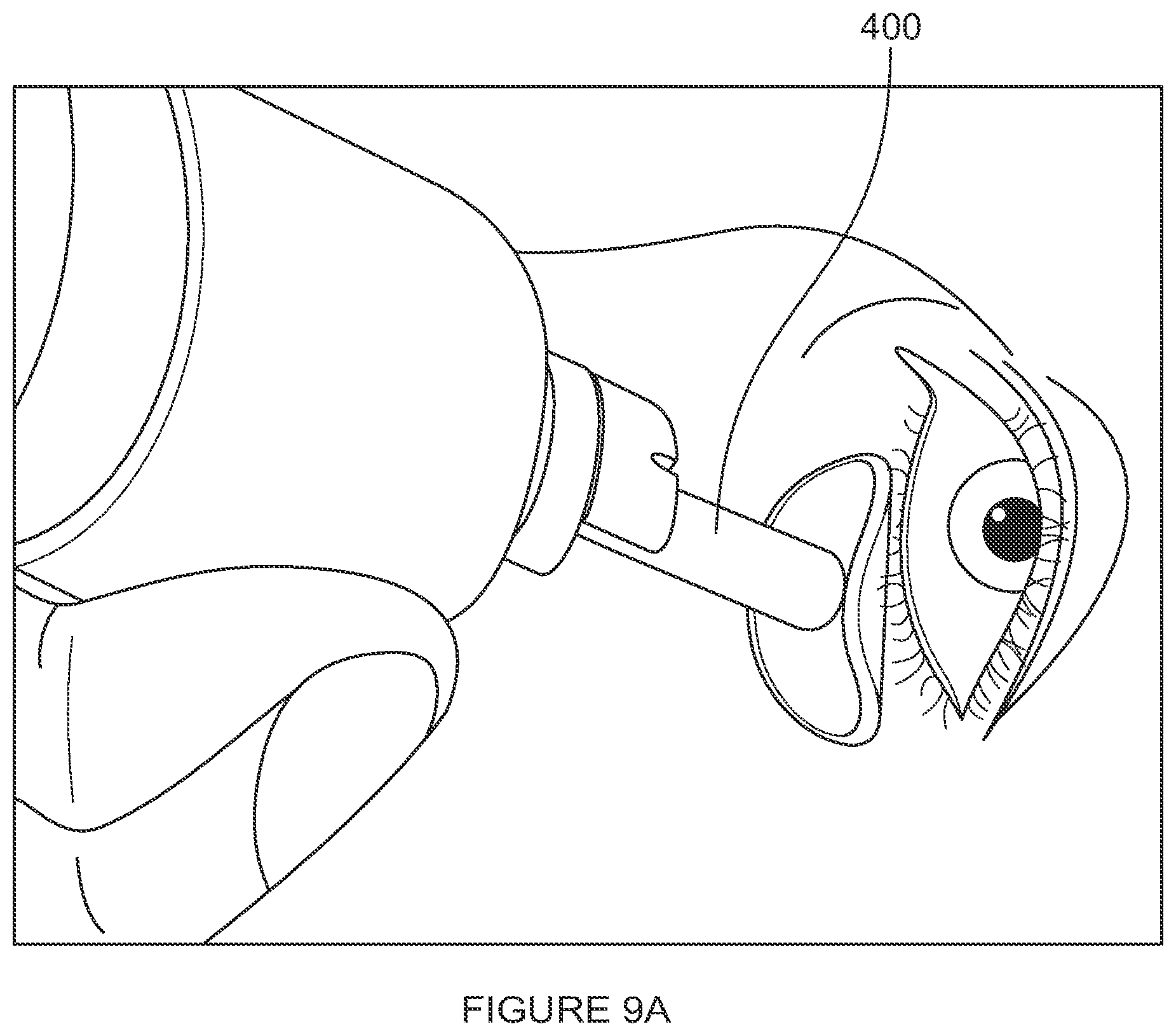 Patent US12102561 Figure 12 – Multi-modal thermal therapy for Blepharitis, Meibomian Gland Dysfunction and Dry Eye Syndrome