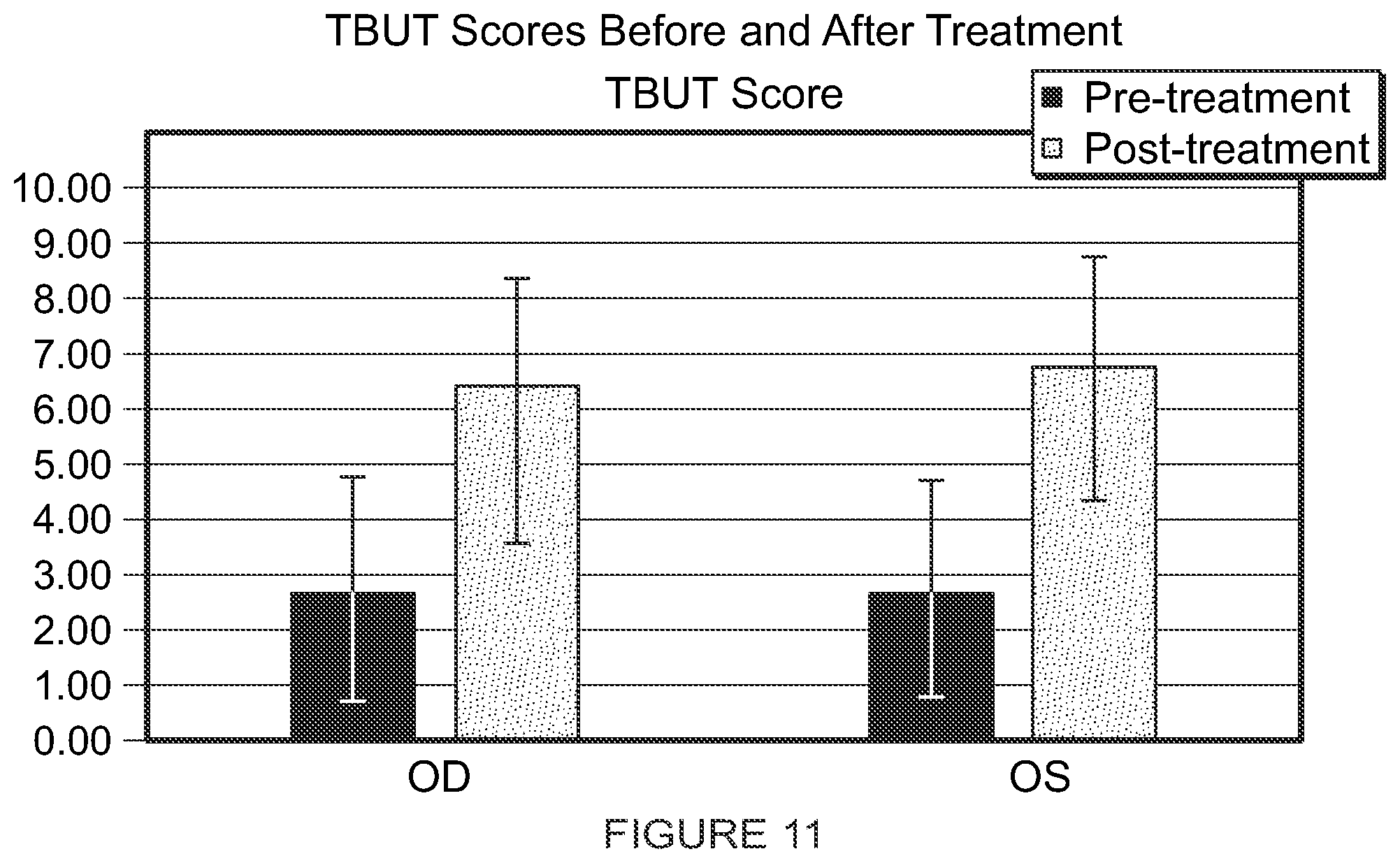 Patent US12102561 Figure 16 – Multi-modal thermal therapy for Blepharitis, Meibomian Gland Dysfunction and Dry Eye Syndrome