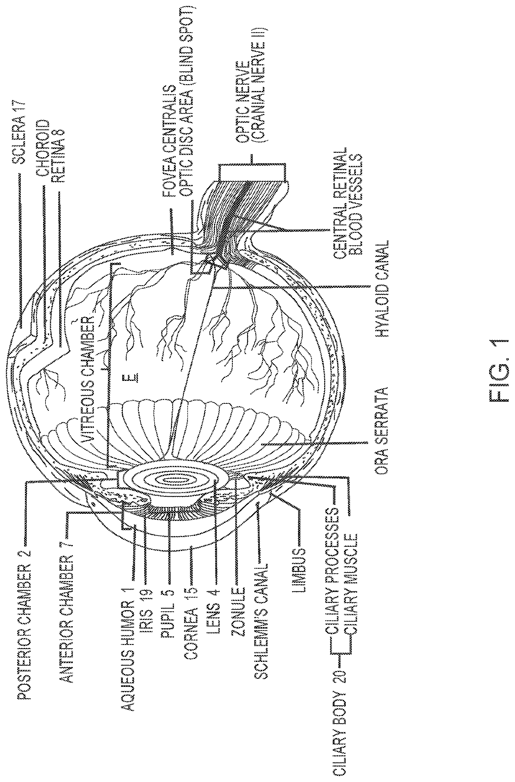 Patent US12102562 Figure 1 – Methods and systems for OCT guided glaucoma surgery