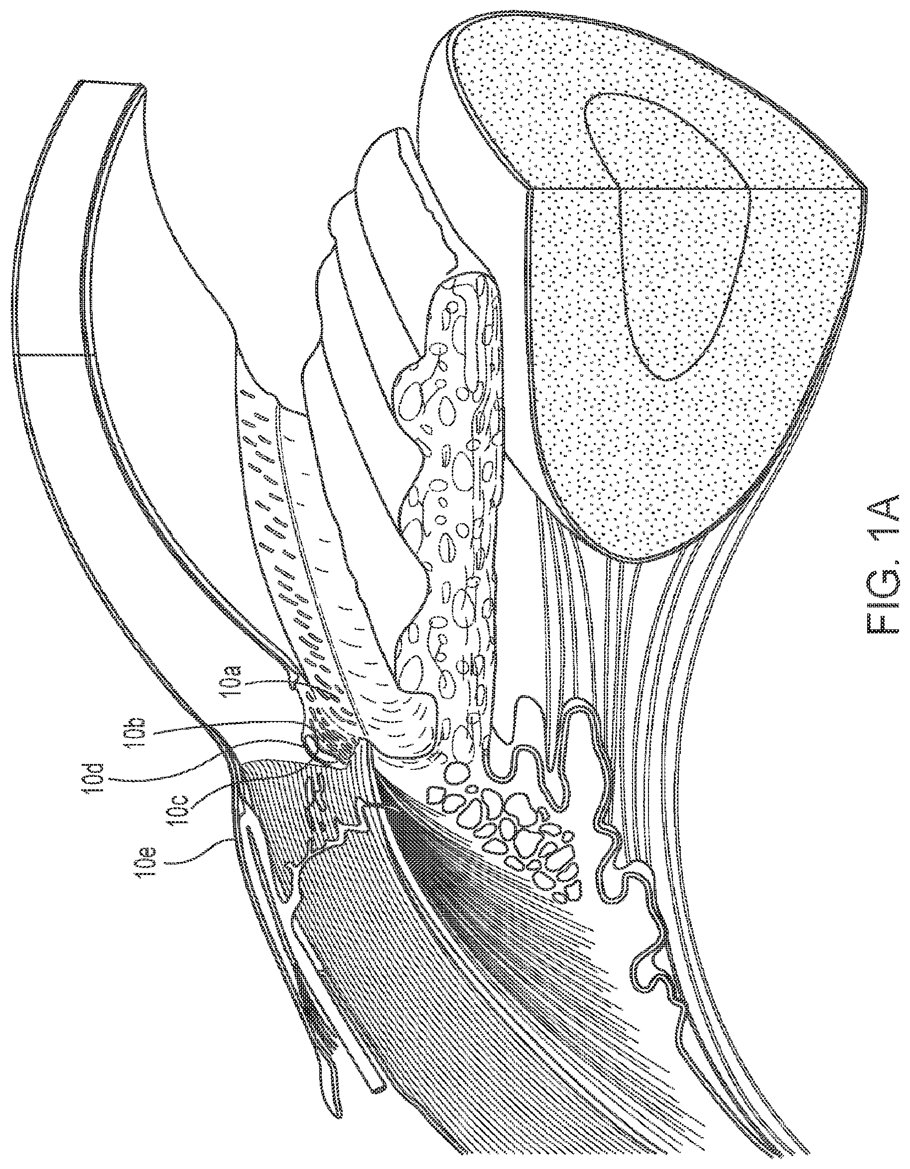 Patent US12102562 Figure 2 – Methods and systems for OCT guided glaucoma surgery