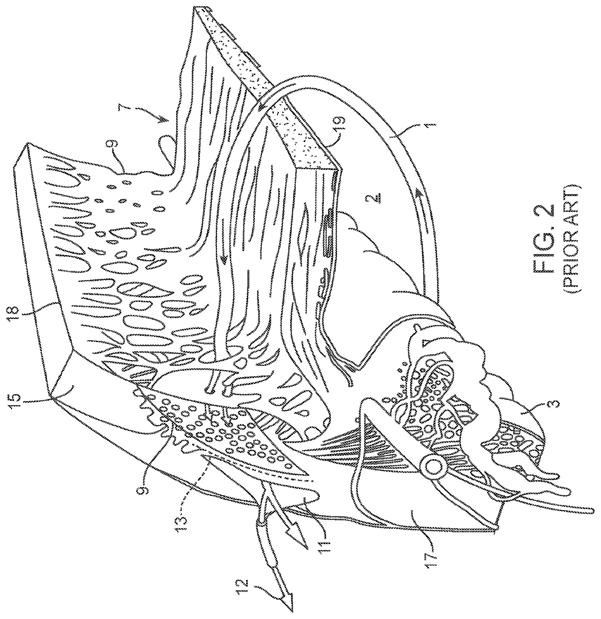 Patent US12102562 Figure 3 – Methods and systems for OCT guided glaucoma surgery
