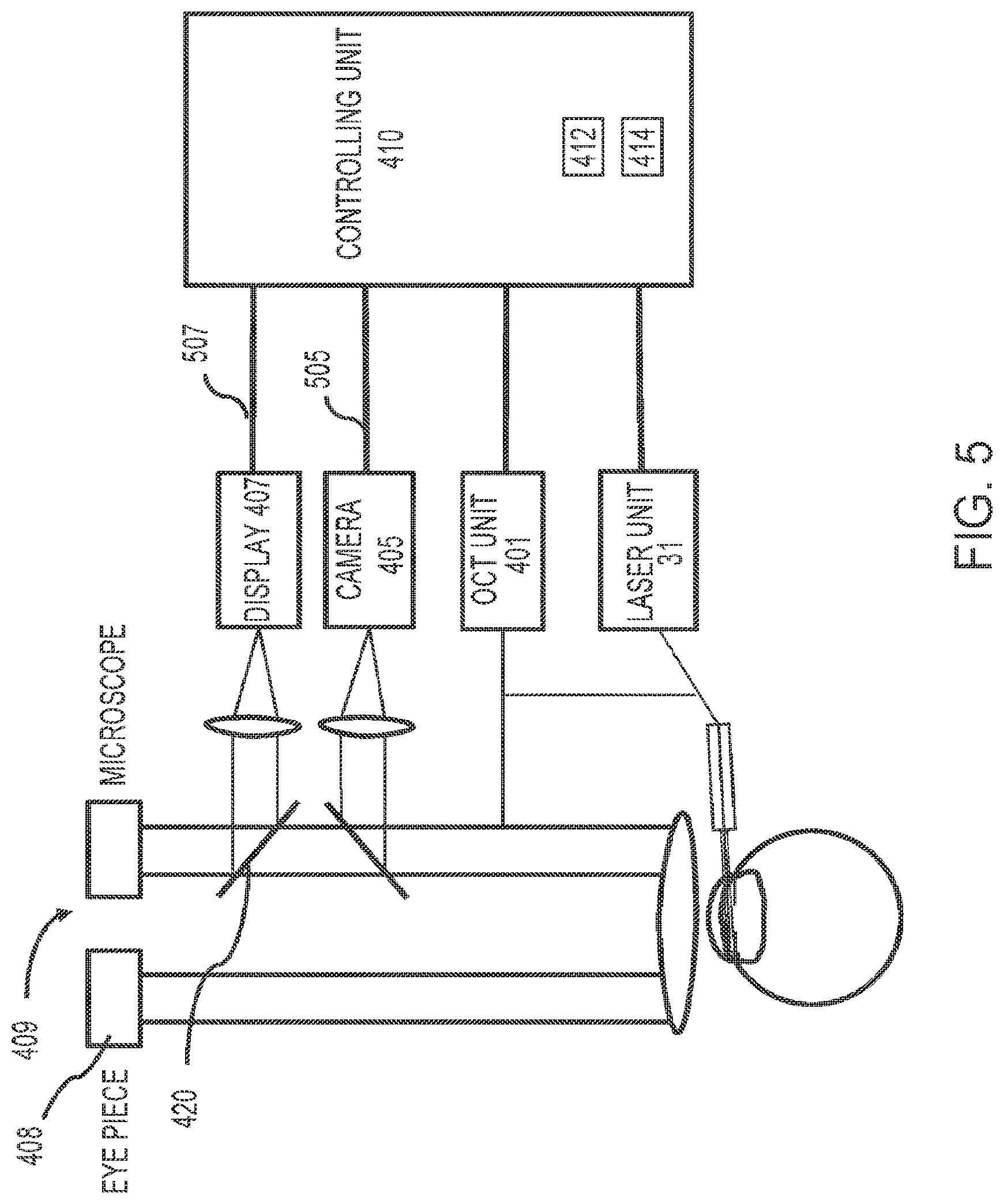 Patent US12102562 Figure 6 – Methods and systems for OCT guided glaucoma surgery
