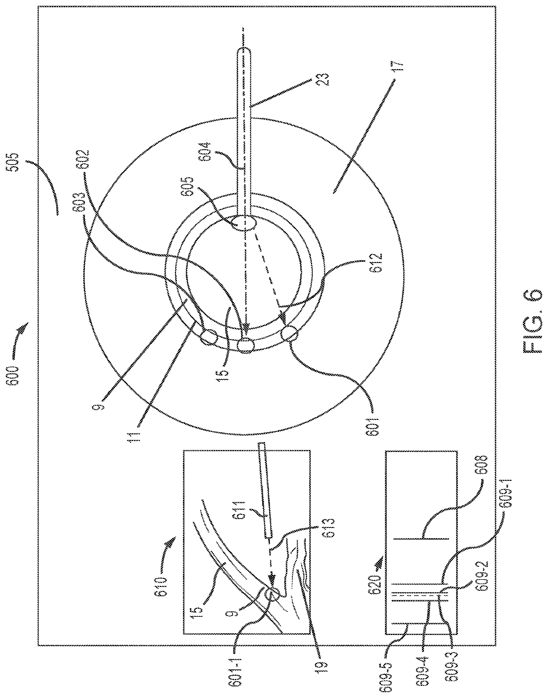 Patent US12102562 Figure 7 – Methods and systems for OCT guided glaucoma surgery