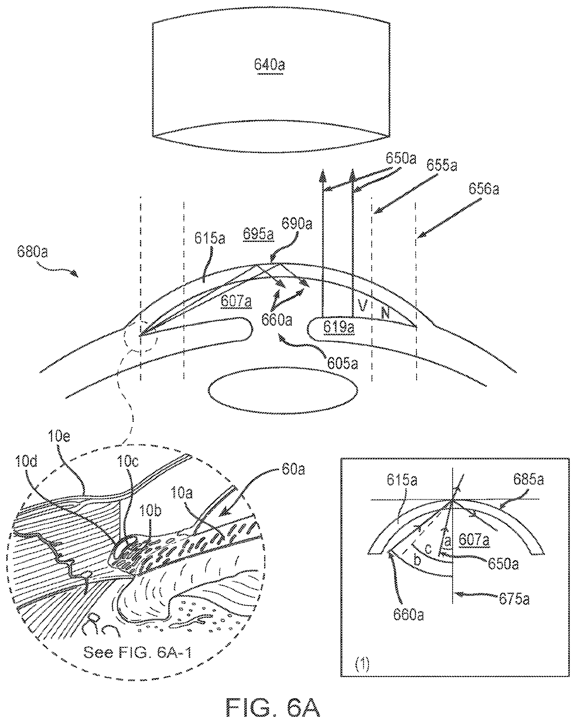 Patent US12102562 Figure 8 – Methods and systems for OCT guided glaucoma surgery