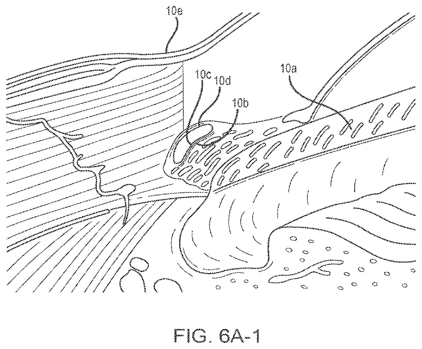 Patent US12102562 Figure 9 – Methods and systems for OCT guided glaucoma surgery