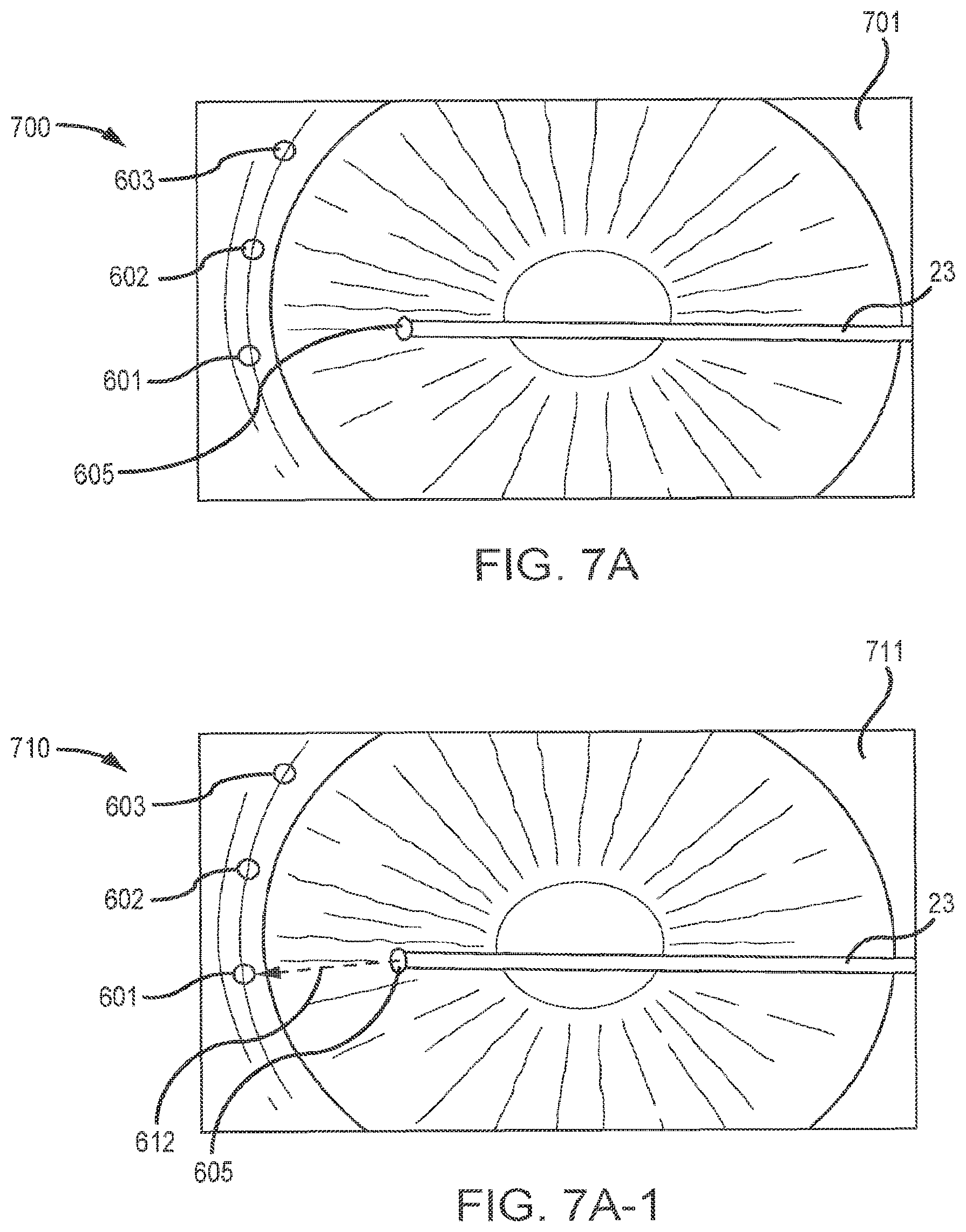 Patent US12102562 Figure 14 – Methods and systems for OCT guided glaucoma surgery