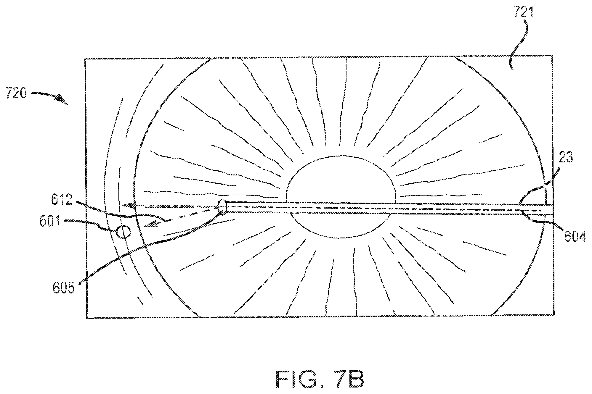 Patent US12102562 Figure 15 – Methods and systems for OCT guided glaucoma surgery