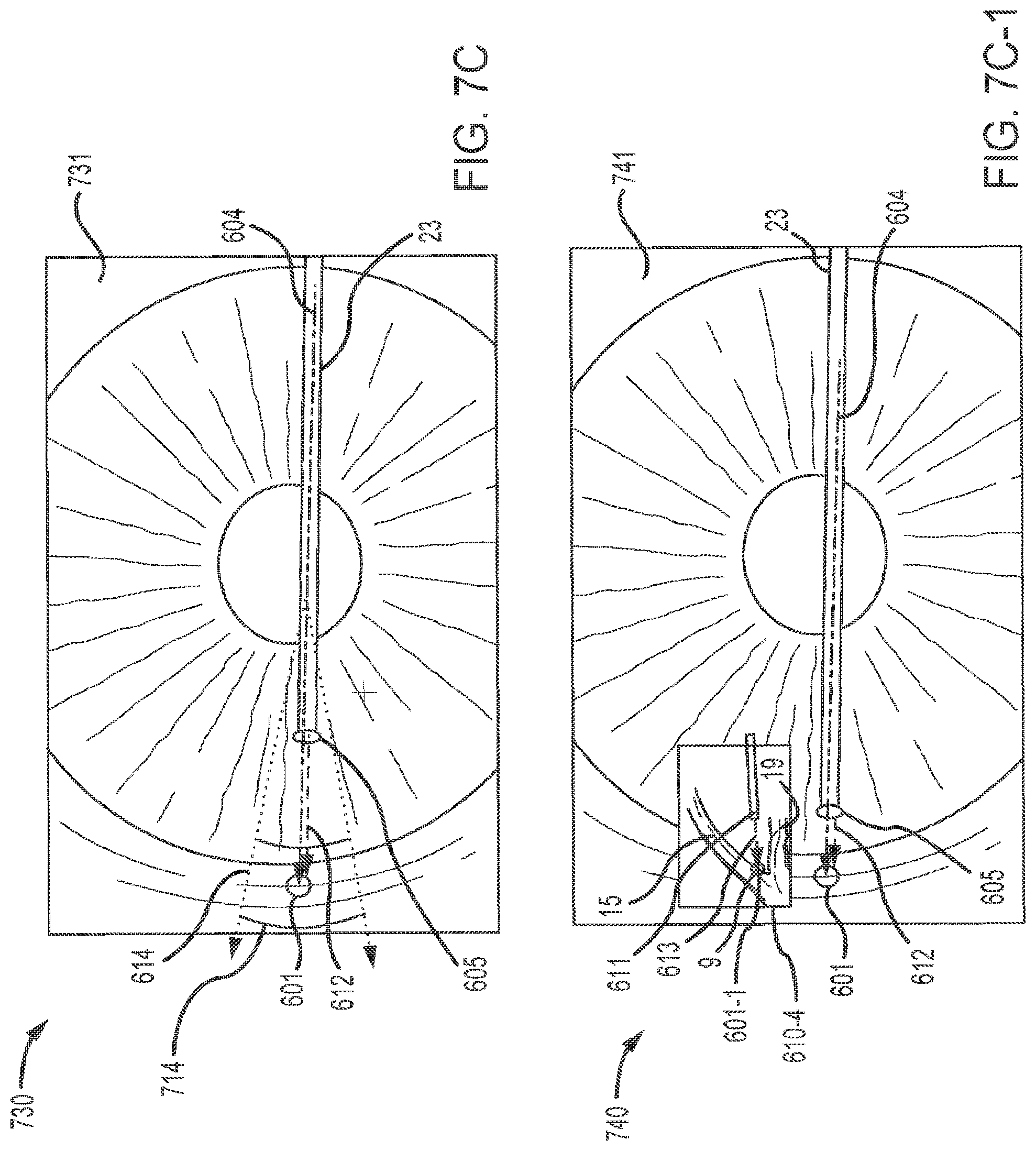 Patent US12102562 Figure 16 – Methods and systems for OCT guided glaucoma surgery