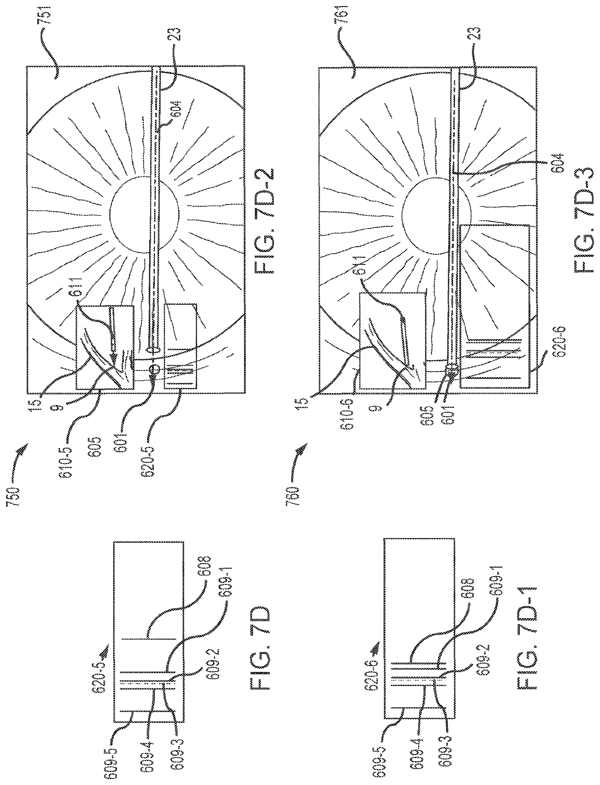 Patent US12102562 Figure 17 – Methods and systems for OCT guided glaucoma surgery