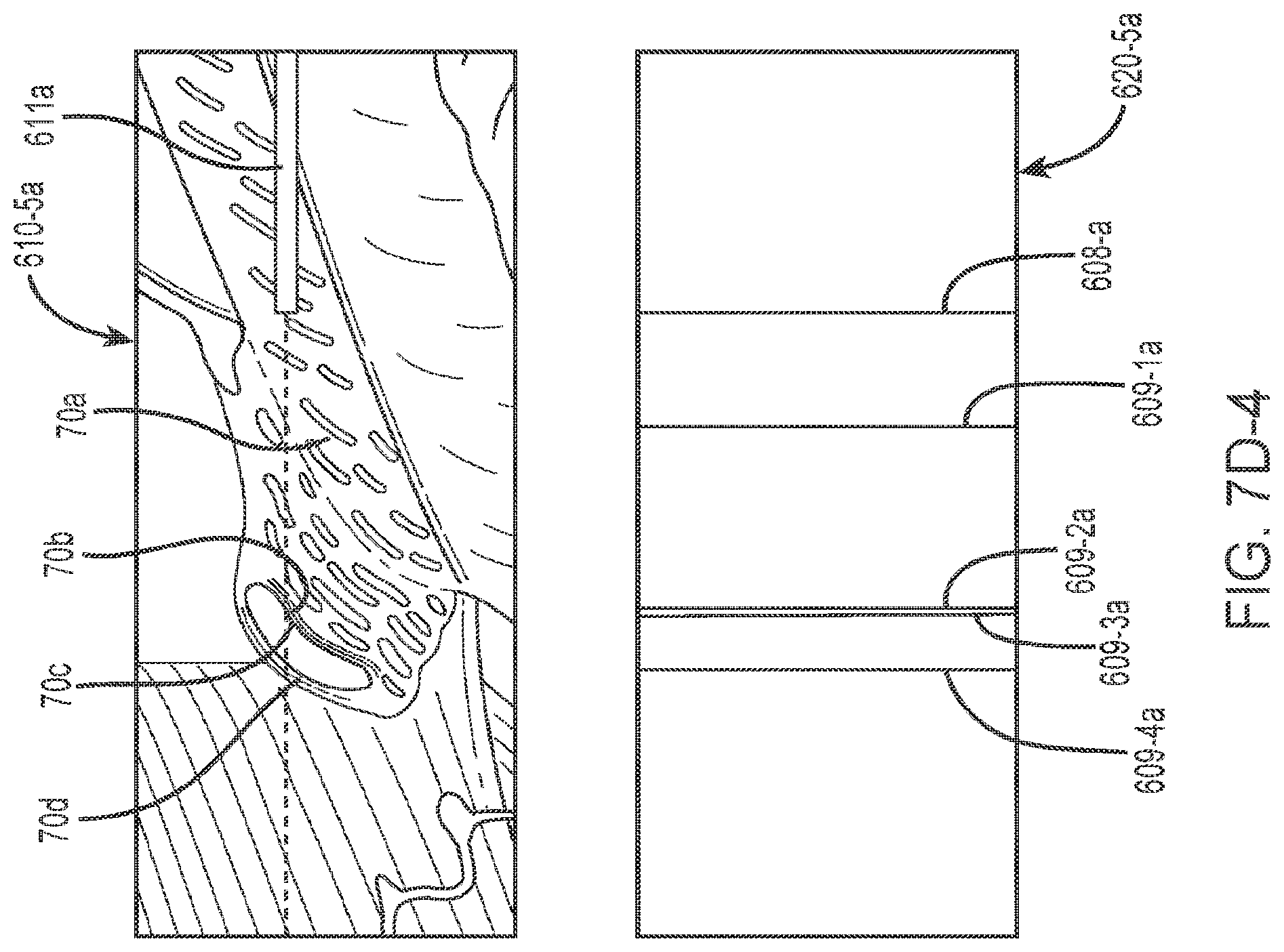 Patent US12102562 Figure 18 – Methods and systems for OCT guided glaucoma surgery