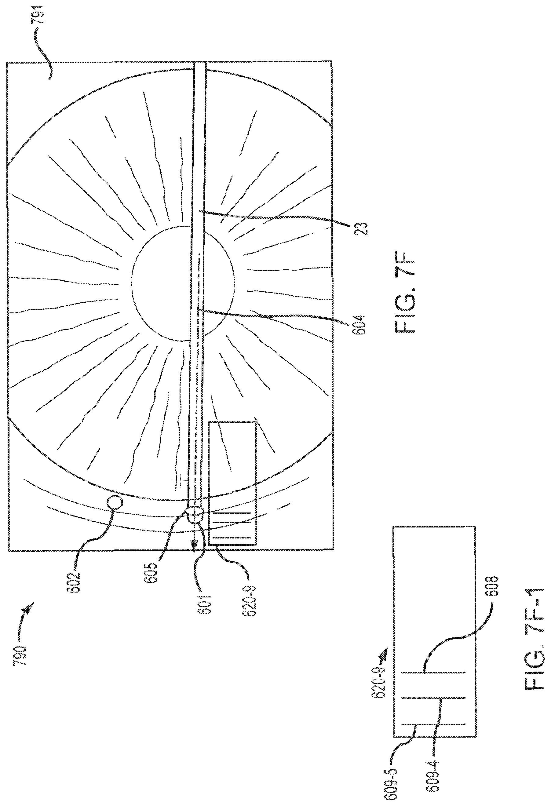 Patent US12102562 Figure 20 – Methods and systems for OCT guided glaucoma surgery