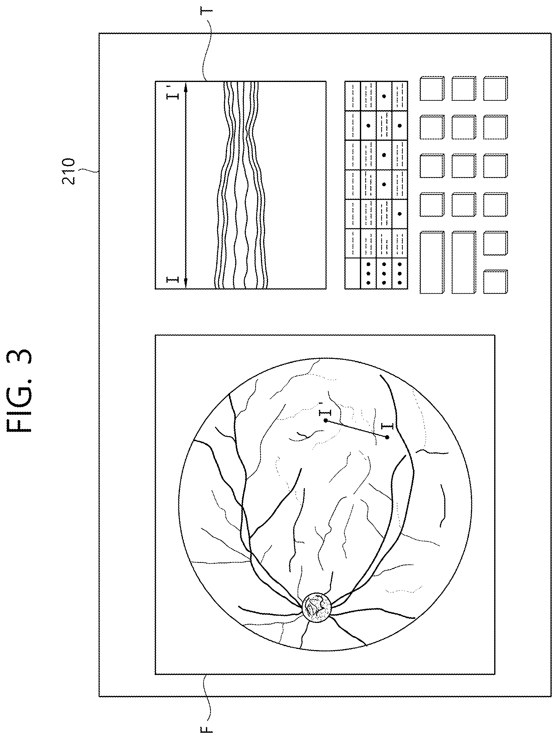 Patent US12102564 Figure 3 – Ophthalmic therapeutic device and control method therefor
