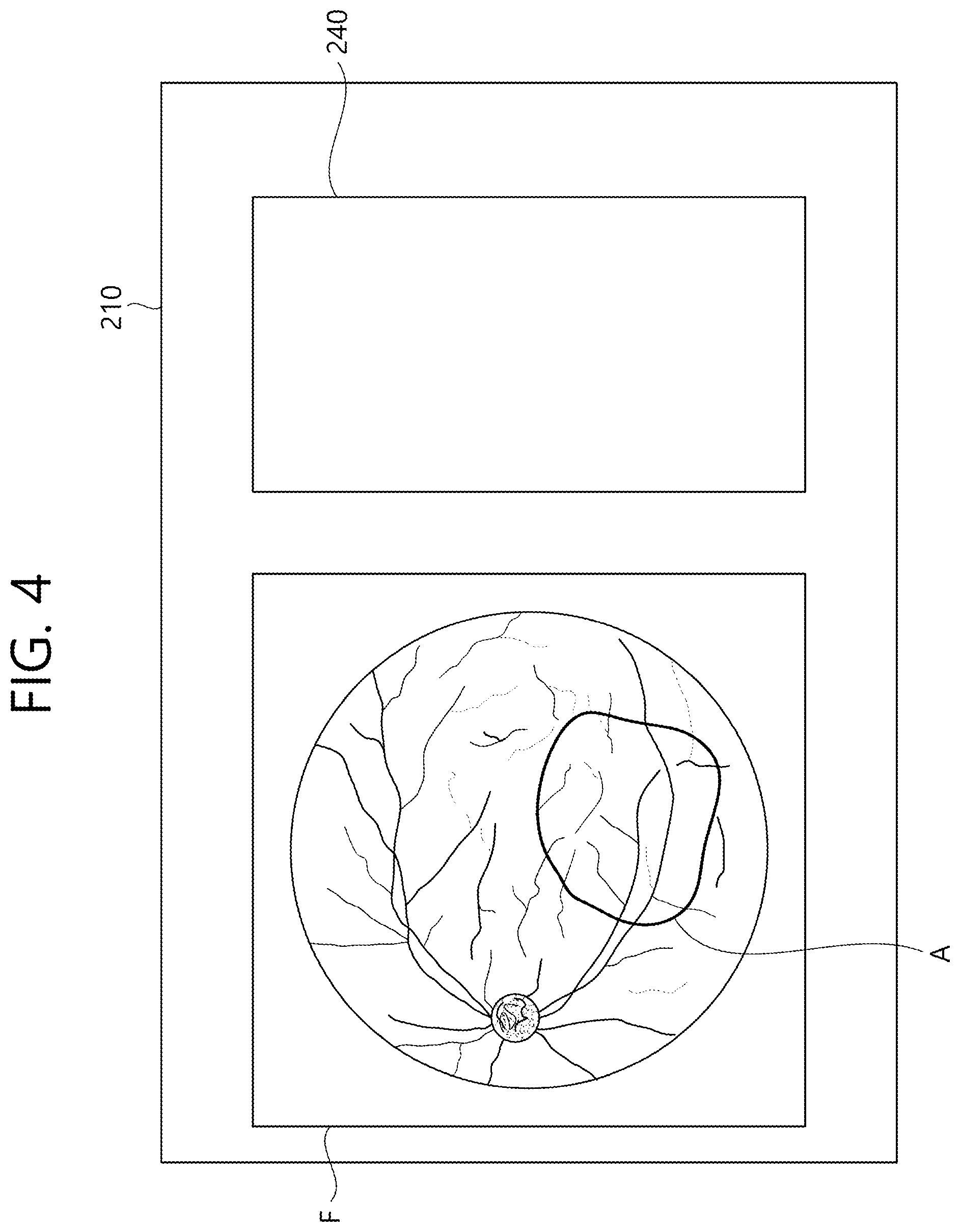 Patent US12102564 Figure 4 – Ophthalmic therapeutic device and control method therefor