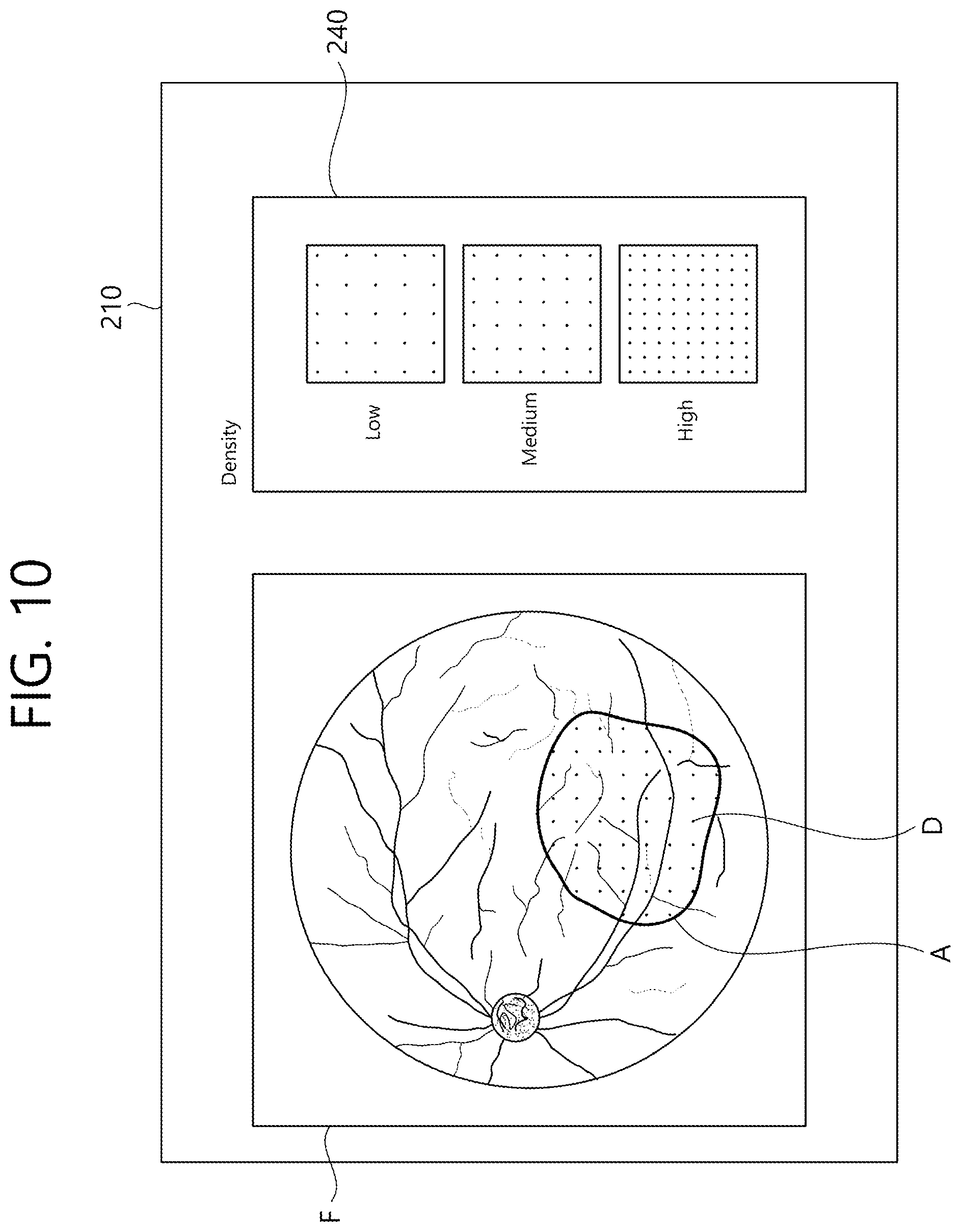 Patent US12102564 Figure 10 – Ophthalmic therapeutic device and control method therefor