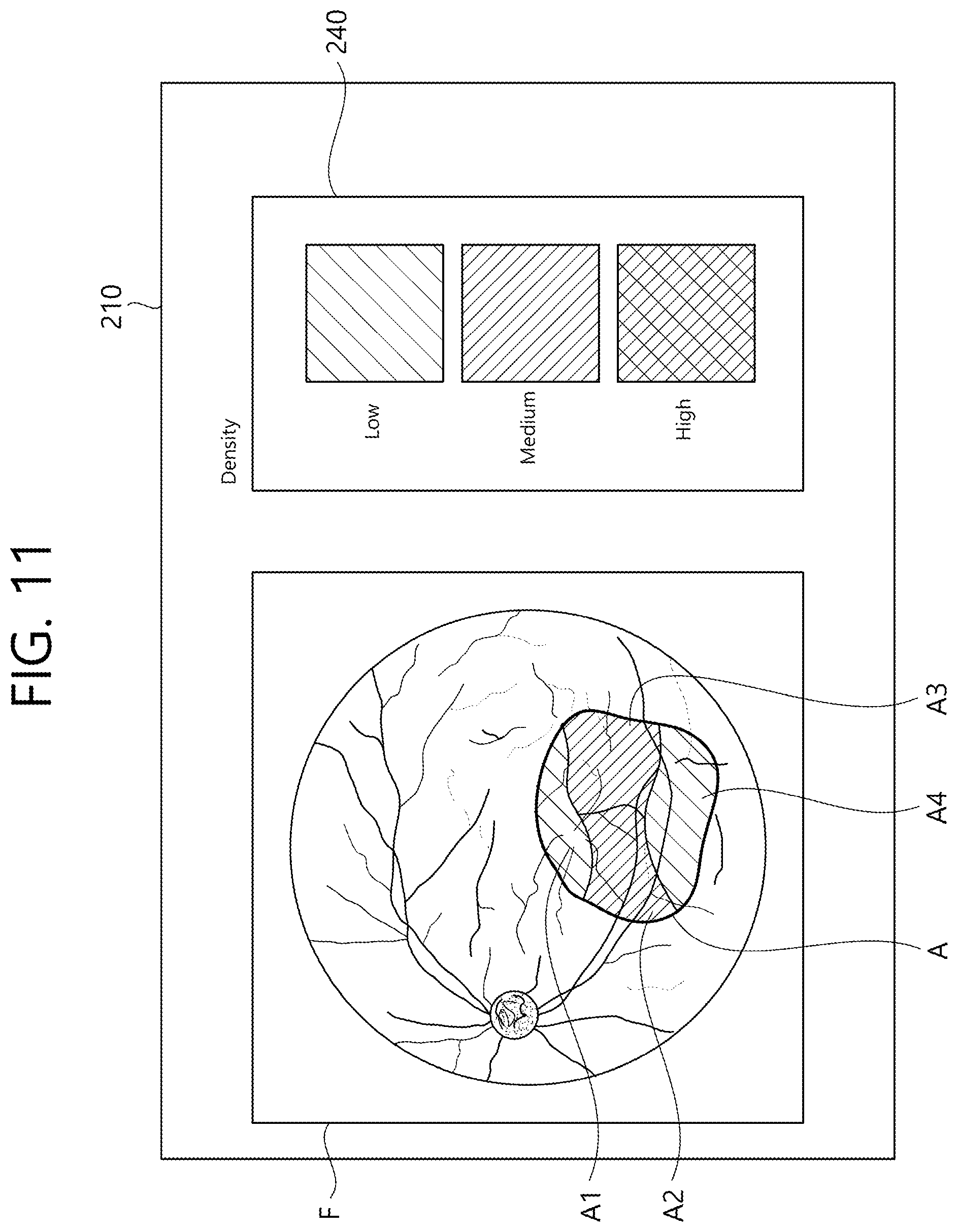 Patent US12102564 Figure 11 – Ophthalmic therapeutic device and control method therefor
