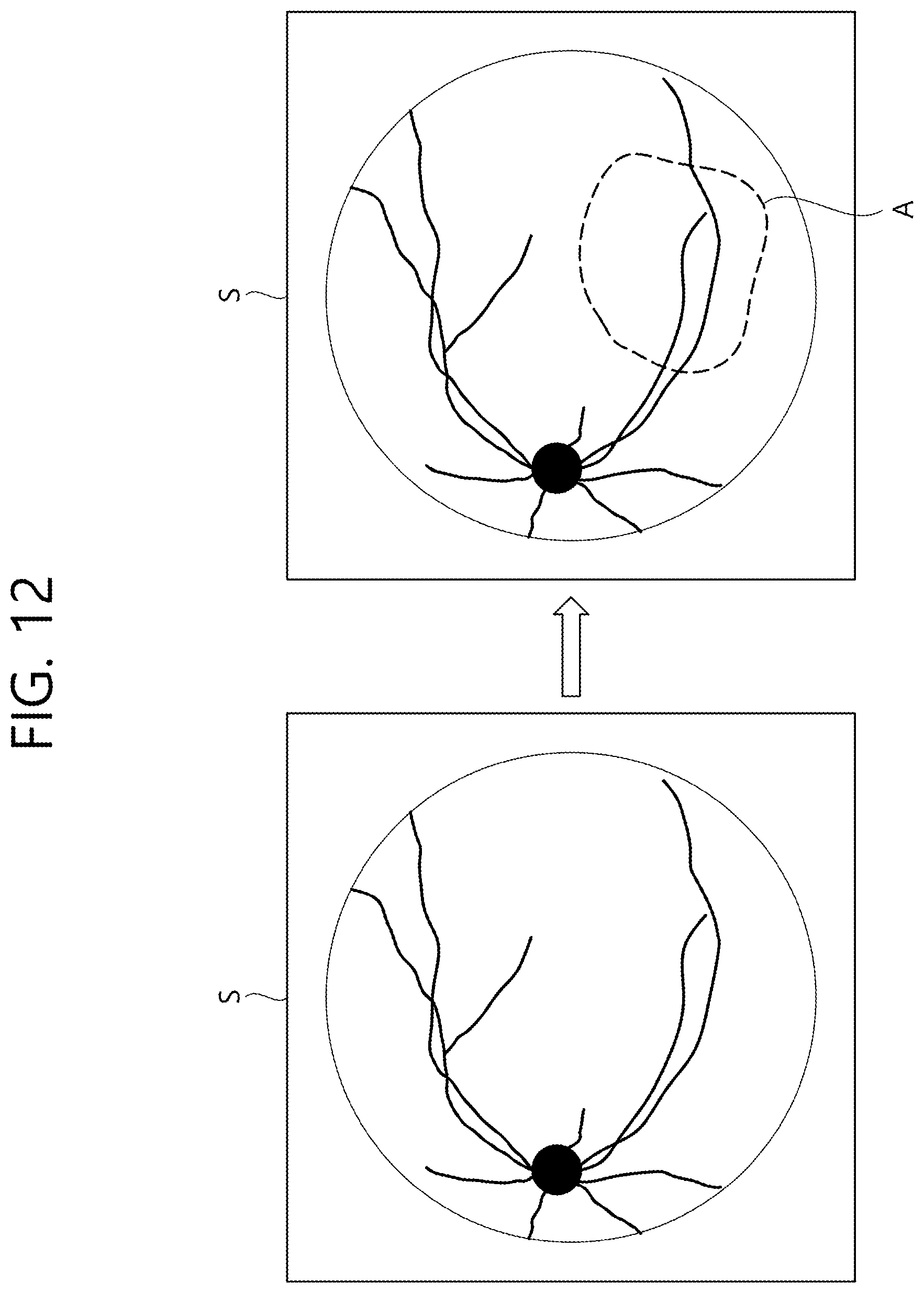 Patent US12102564 Figure 12 – Ophthalmic therapeutic device and control method therefor