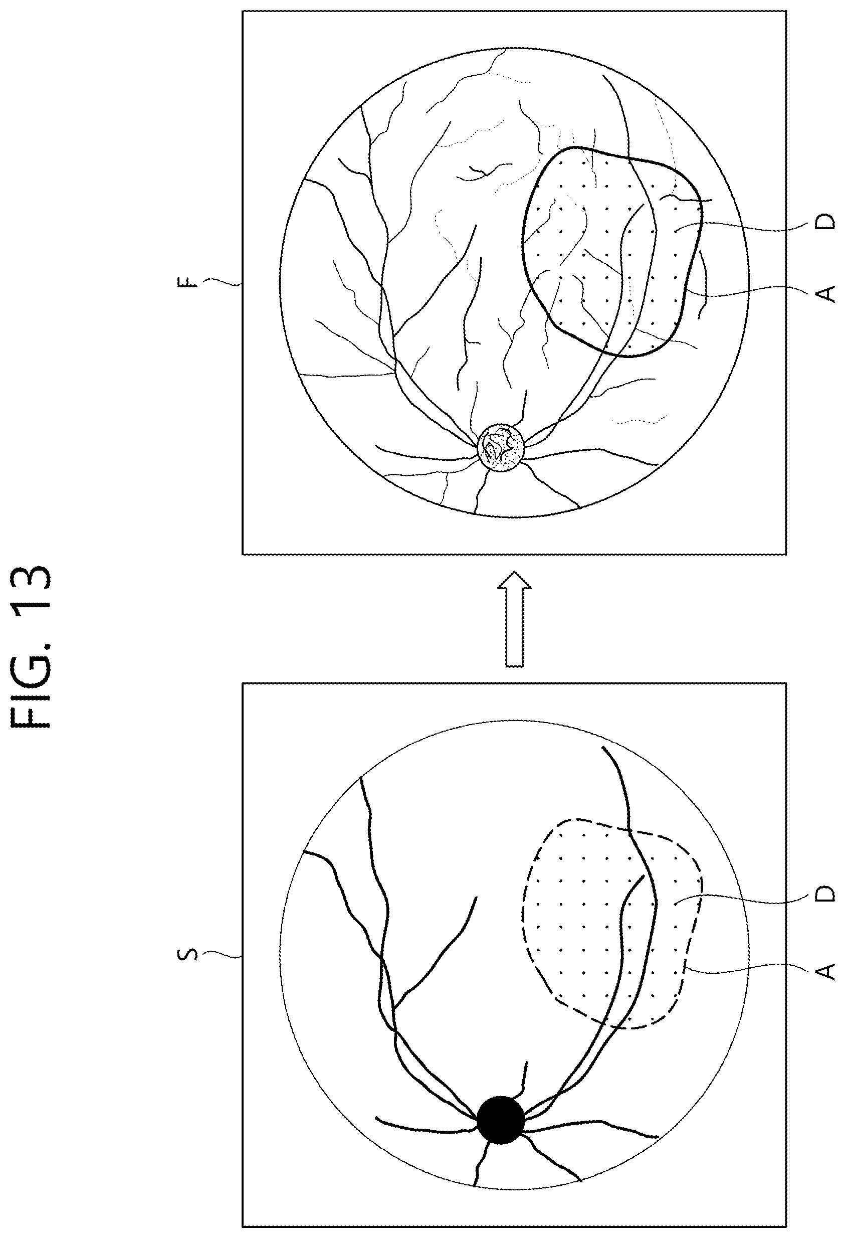 Patent US12102564 Figure 13 – Ophthalmic therapeutic device and control method therefor