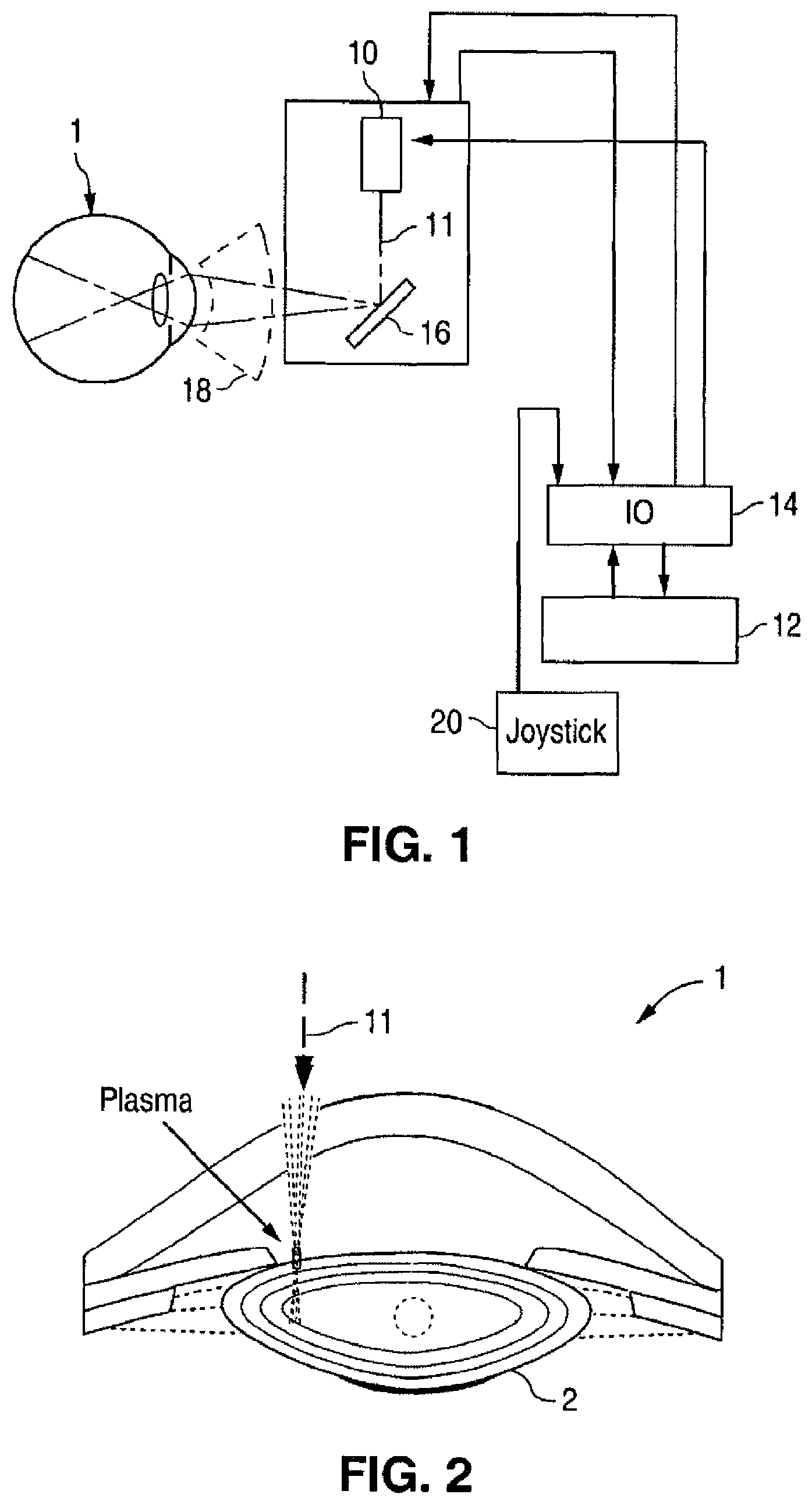 Patent US12102565 — Apparatus for patterned plasma-mediated laser ophthalmic surgery — Figure 1