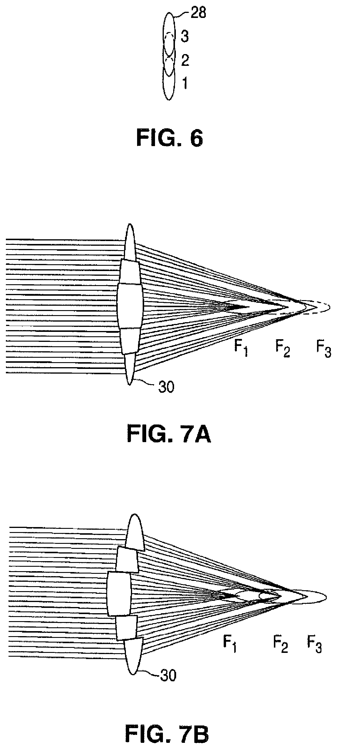 Patent US12102565 Figure 3 – Apparatus for patterned plasma-mediated laser ophthalmic surgery