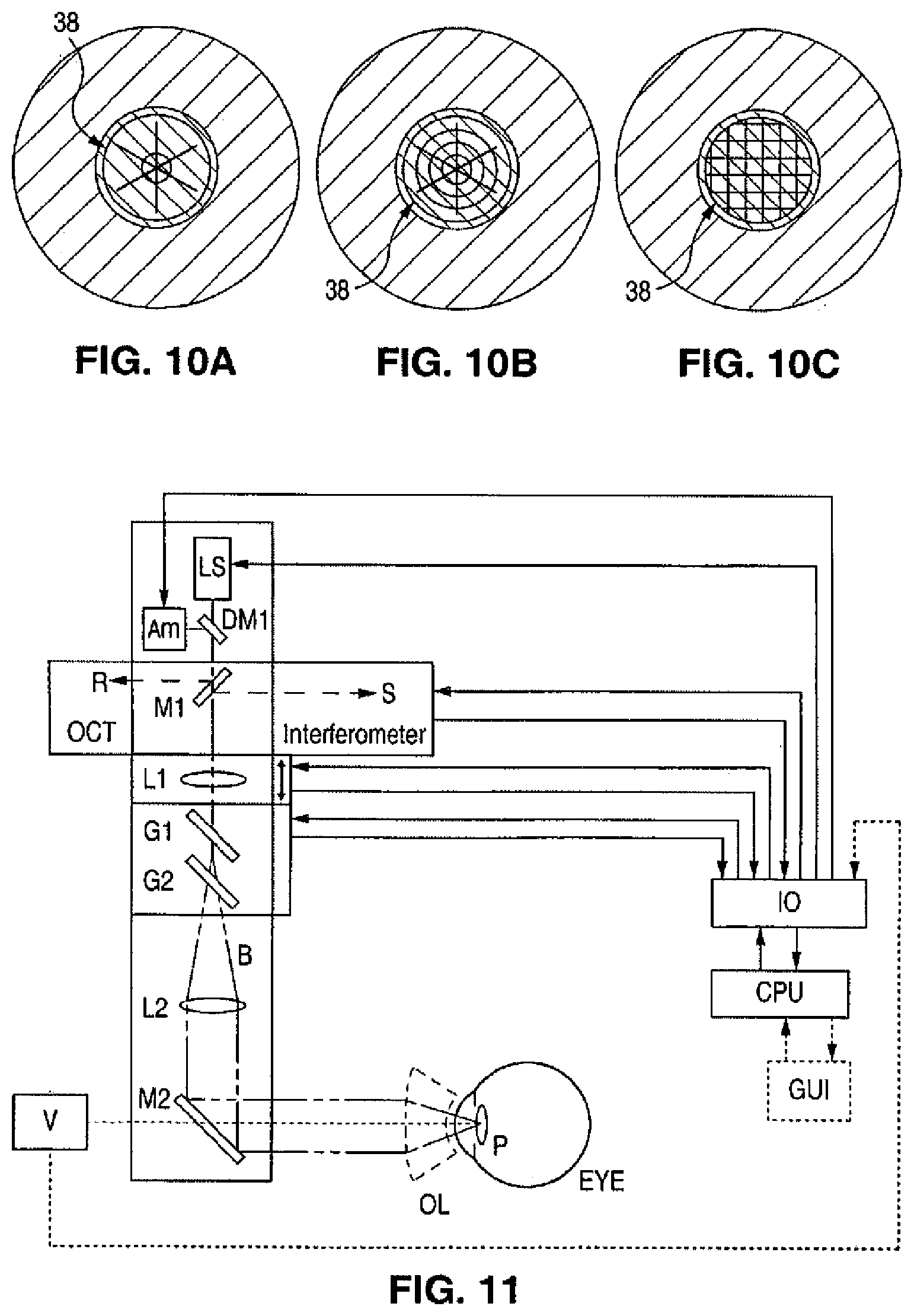 Patent US12102565 Figure 5 – Apparatus for patterned plasma-mediated laser ophthalmic surgery