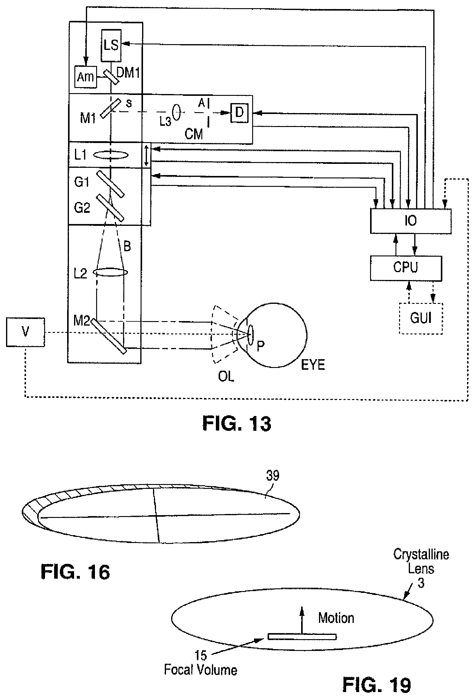 Patent US12102565 Figure 7 – Apparatus for patterned plasma-mediated laser ophthalmic surgery