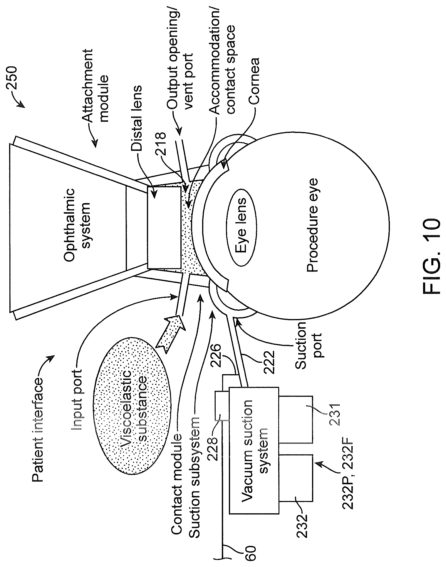 Patent US12102566 Figure 8 – Liquid optical interface for laser eye surgery system