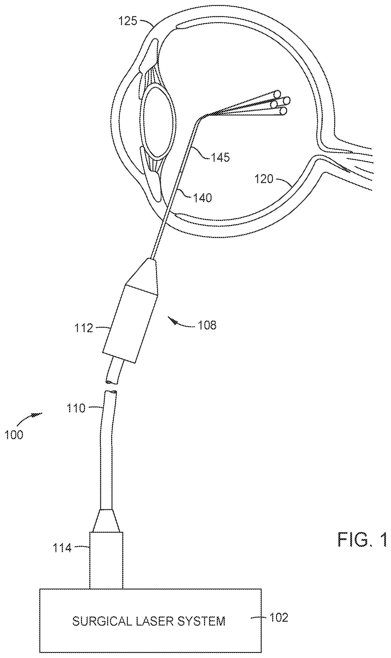Patent US12102567 Figure 1 – Beam detection with dual gain