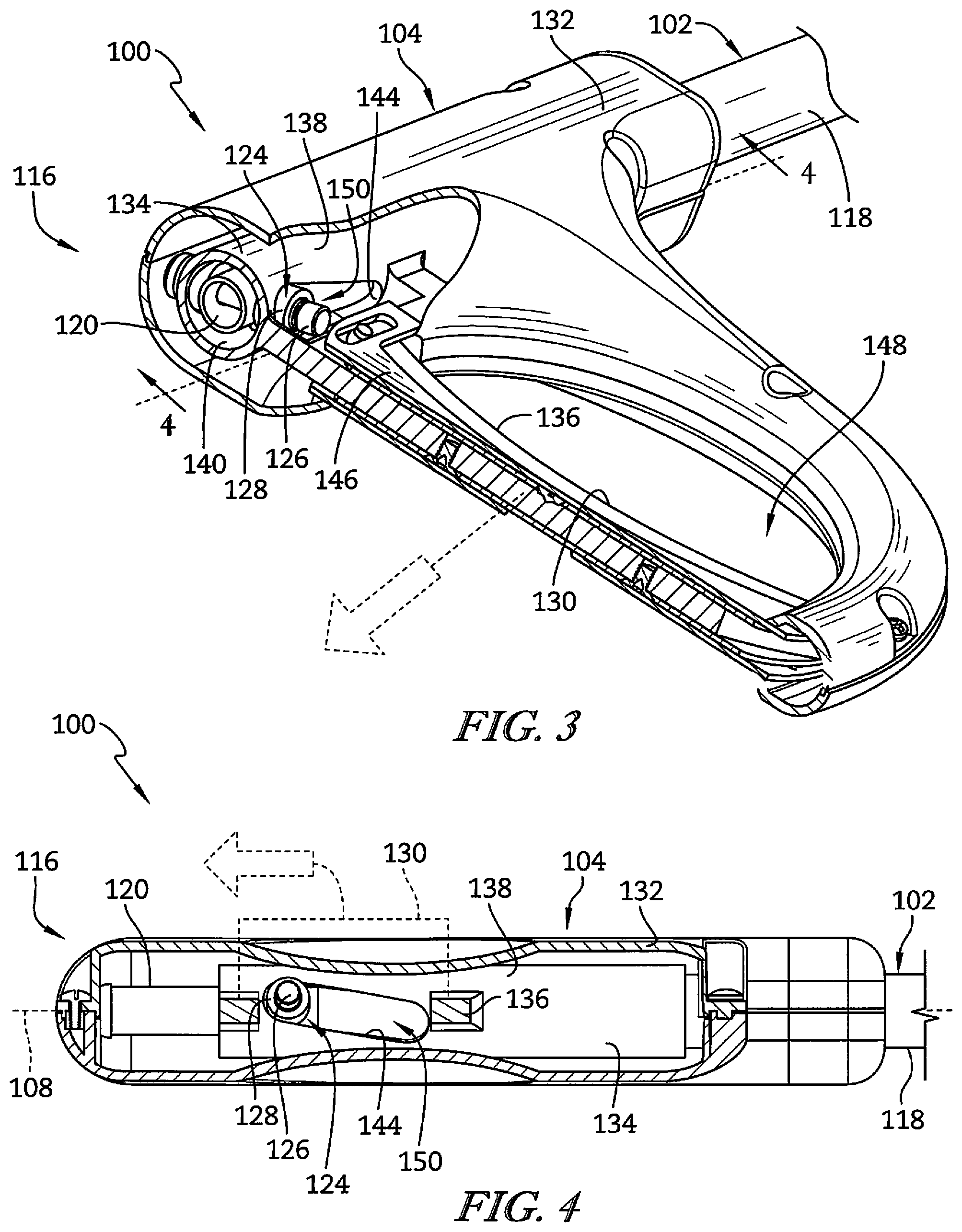 Patent US12102571 Figure 3 – Releasable spar for surgical boot